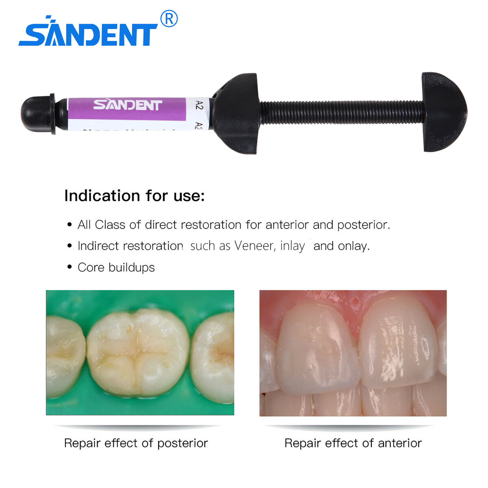 20PCS Dental Composite Universal Light Cure Hybrid Resin A2 Syringe Kit