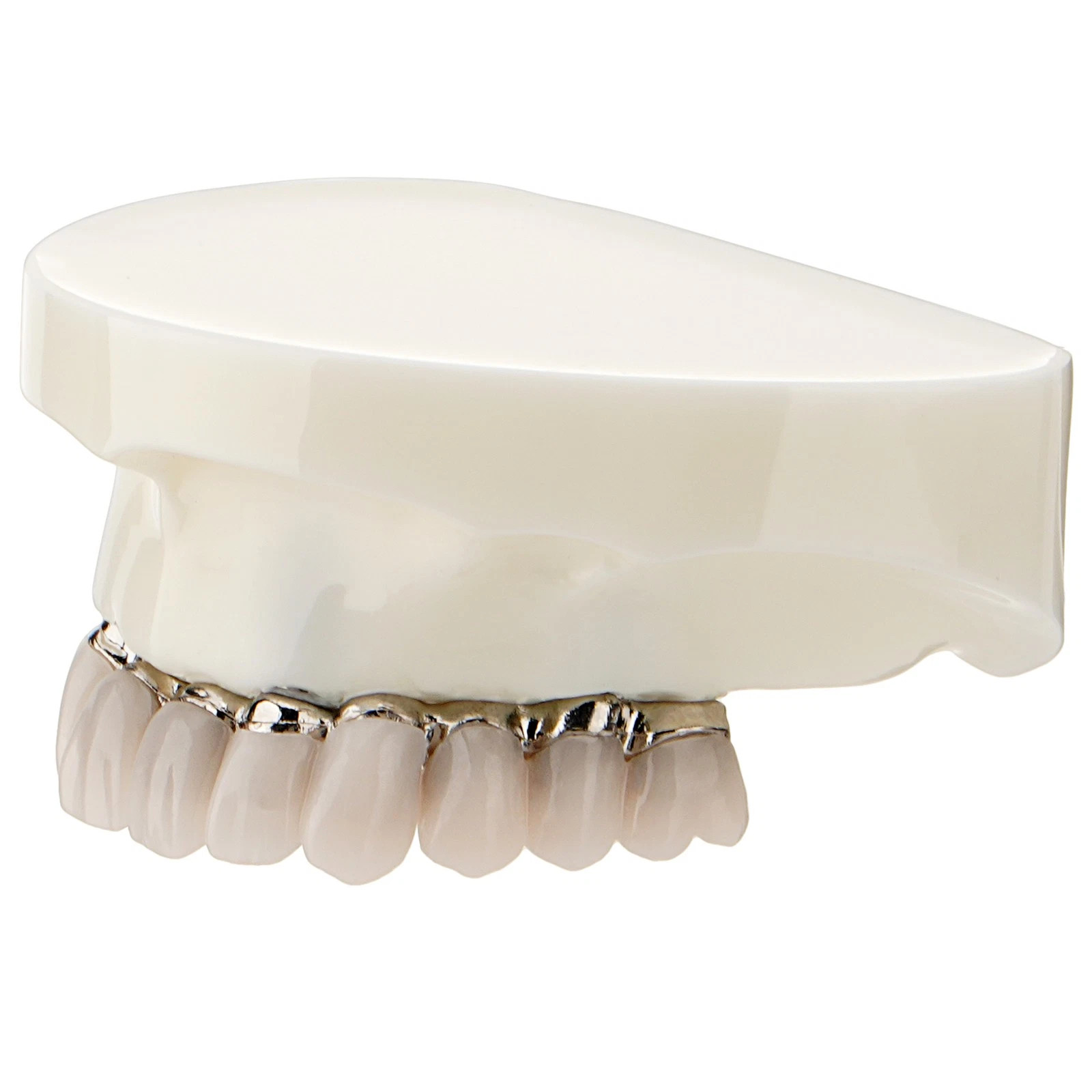 All-on-4 Dental Overdenture Model Dental Upper Jaw Implants Restoration 4 Screws