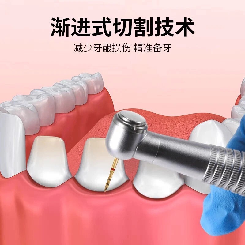 FG7906 牙科垂直钻石 BOPT 预制磨牙导向技术 6 件/套装-