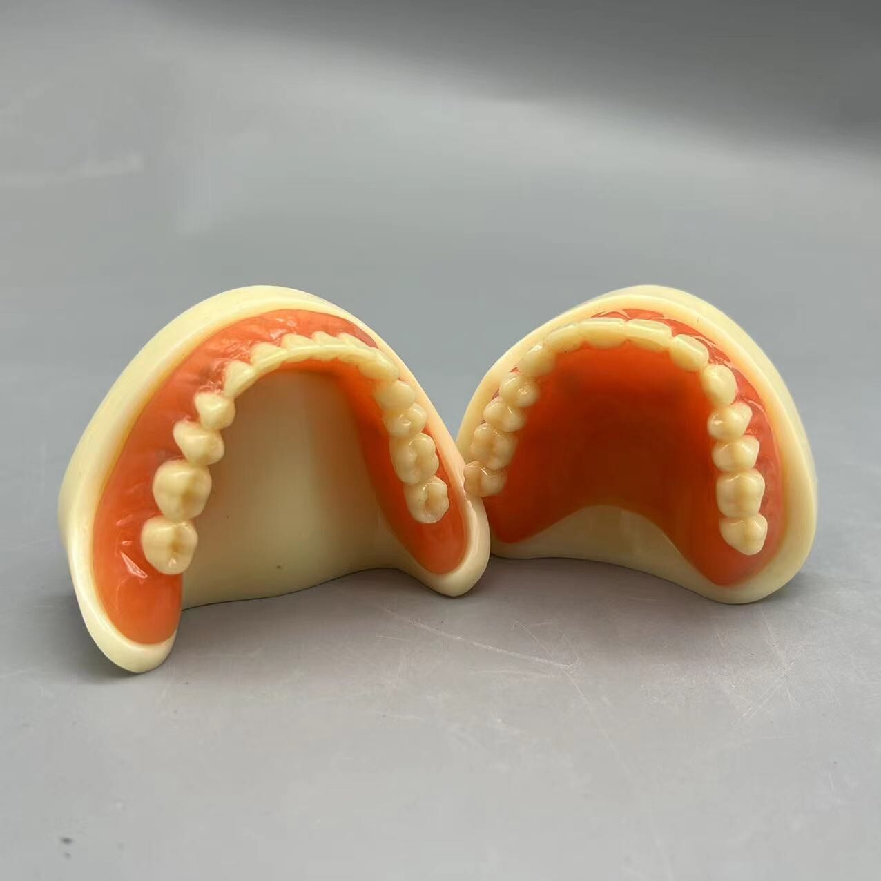 Dental 2 Implants Overdenture Typodont Restoration Upper Lower Lower Teeth Model