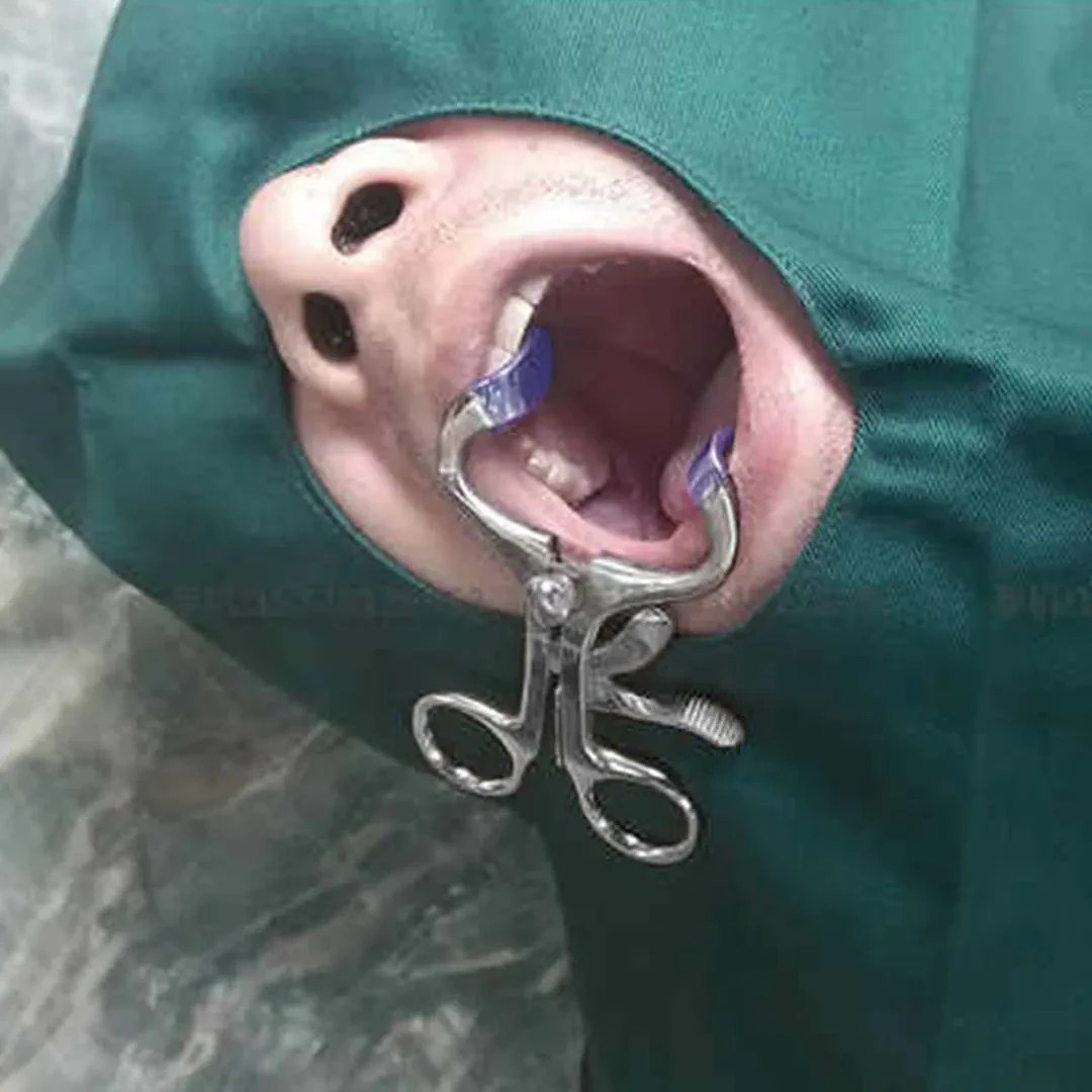 Waldent Mouth Gag Molt 140mm For Adults (8/111) Free Shipping Worldwide