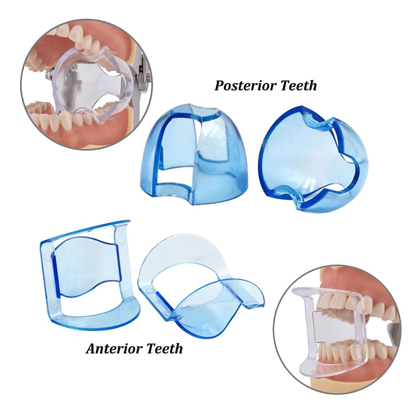 Dental Double Cheek Lip Retractor Teeth Dilator Opener Anterior/Posterior Teeth
