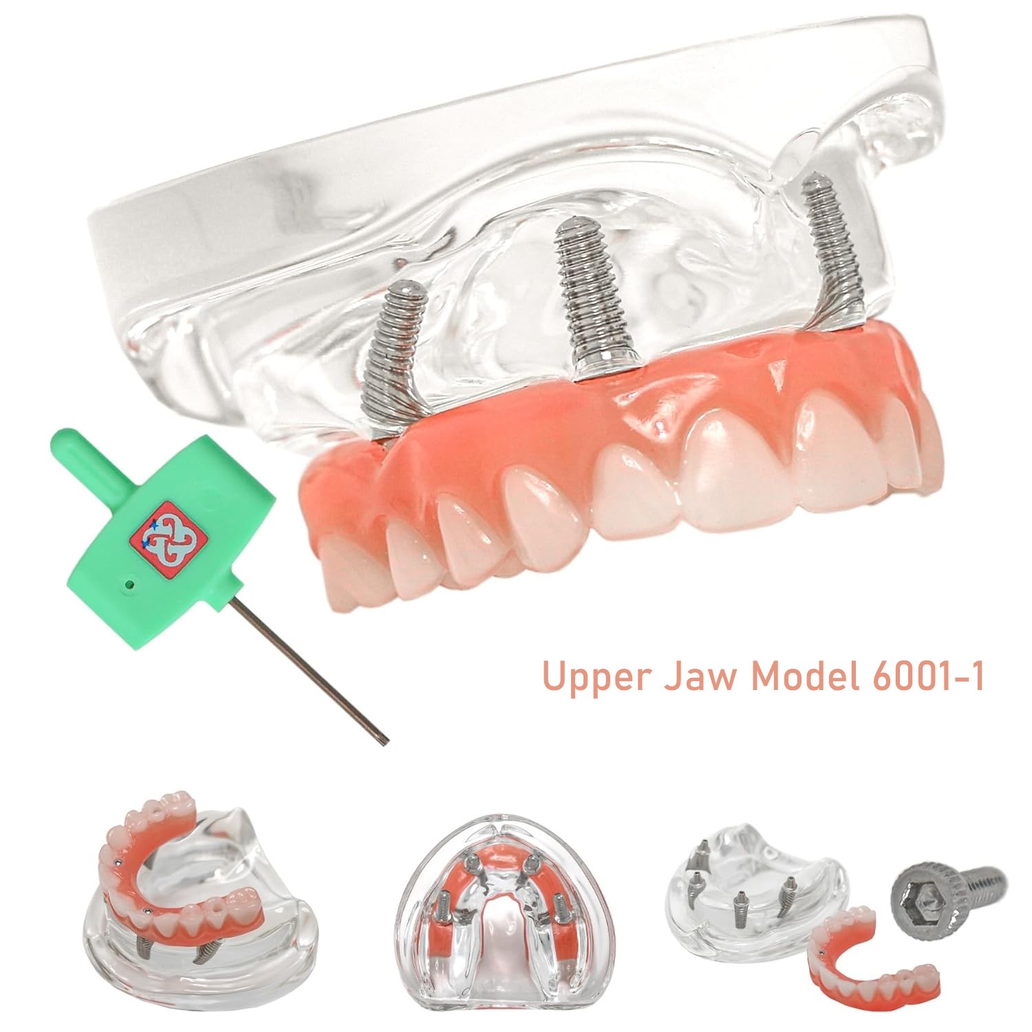 Dental Overdenture Implant Model All-on-4/6 Upper Jaw Restoration 4/6 Screws