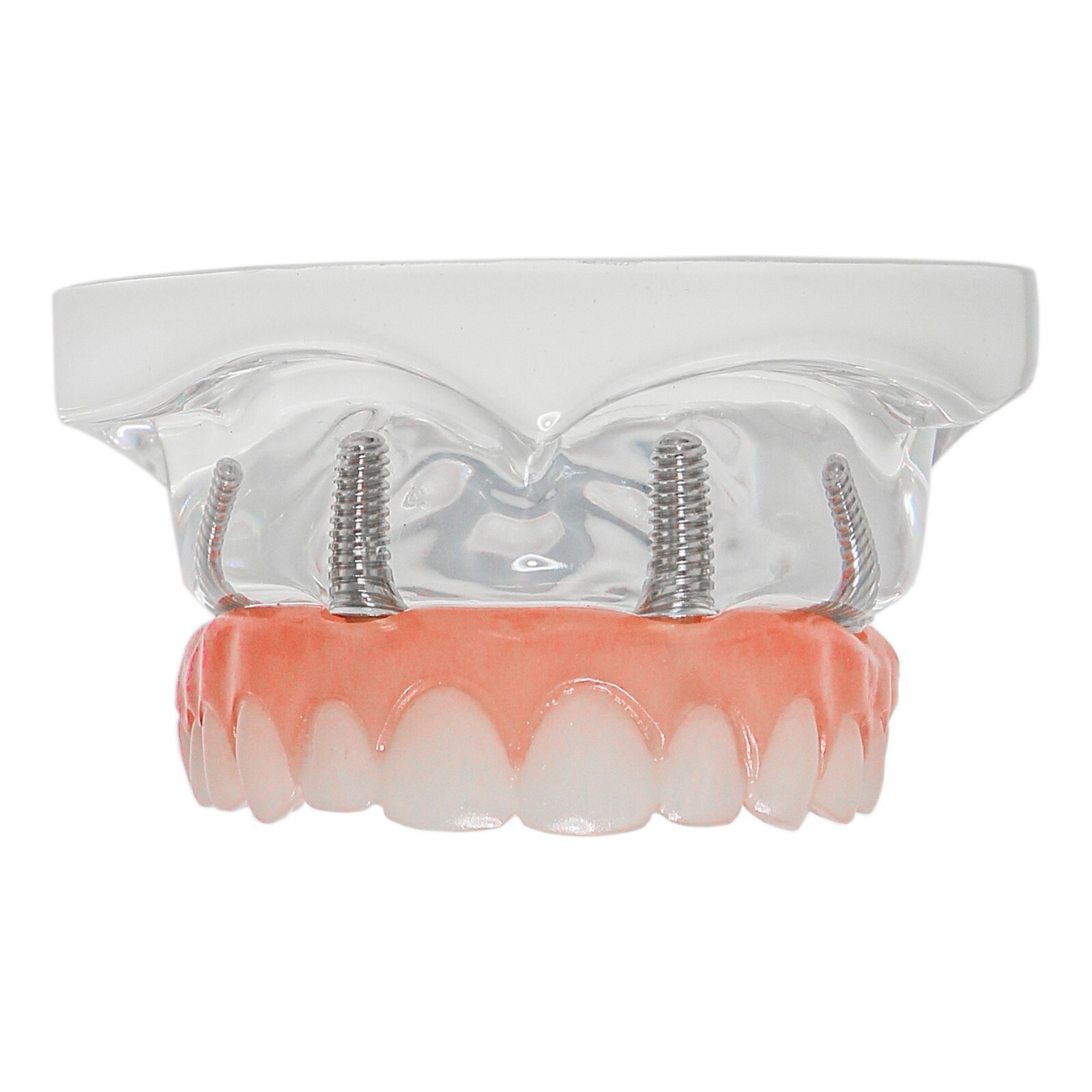 Dental Implant Training Model Upper / Lower Jaw with Overdenture Demo & Base
