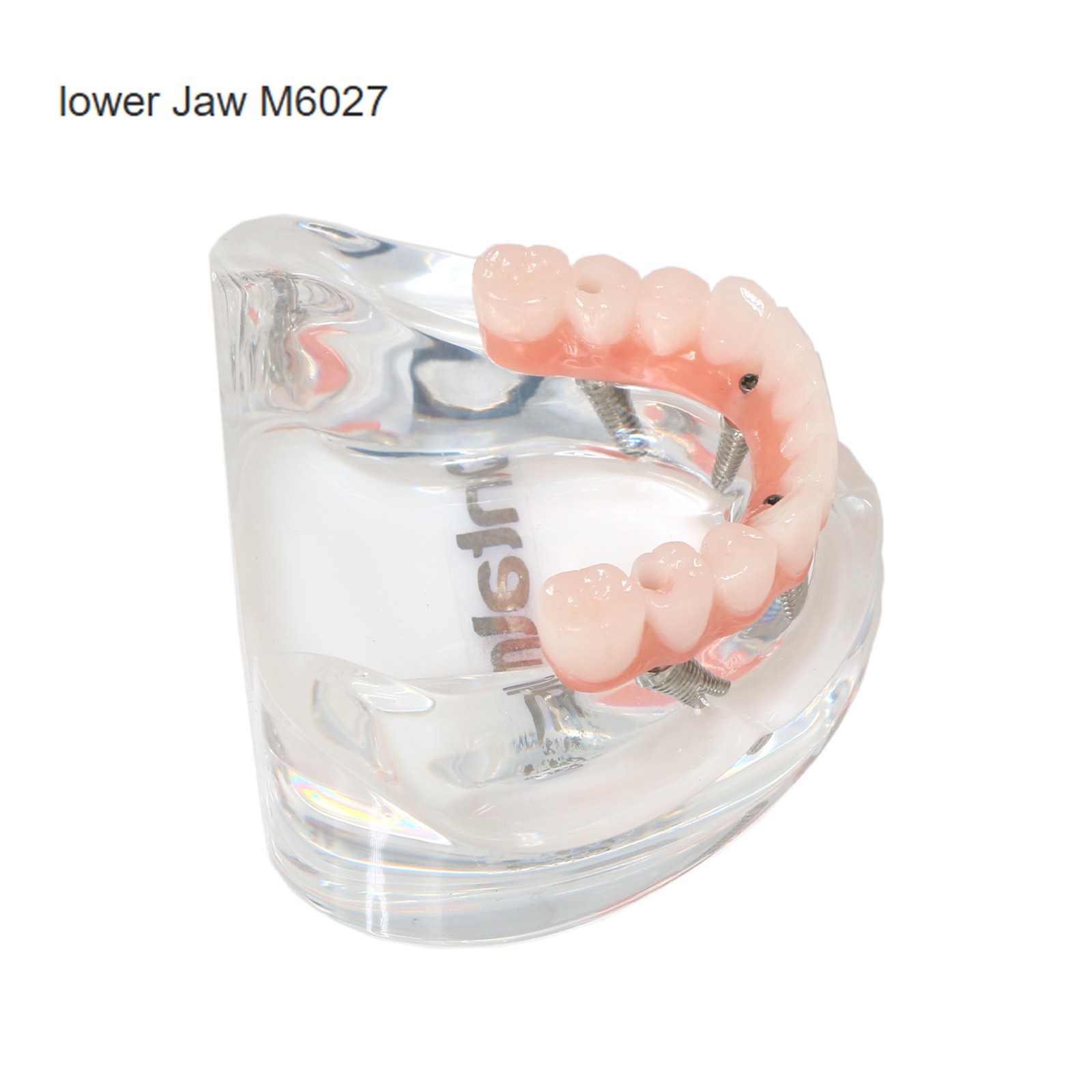 US Dental Implant Teeth Model Overdenture All on 4/All on 6 treatment Demo Model