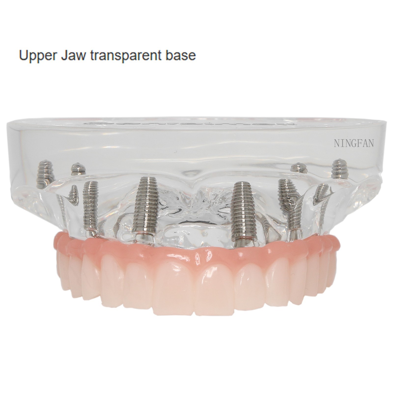 US Dental Implant Teeth Model Overdenture All on 4/All on 6 treatment Demo Model