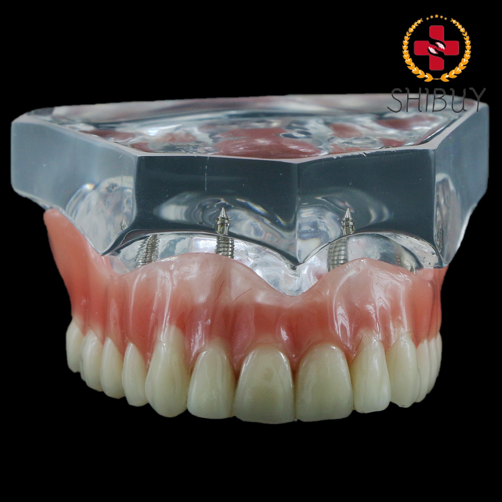 For Upper/Lower Teaching Study Dental Implant Model, Removable Overdenture