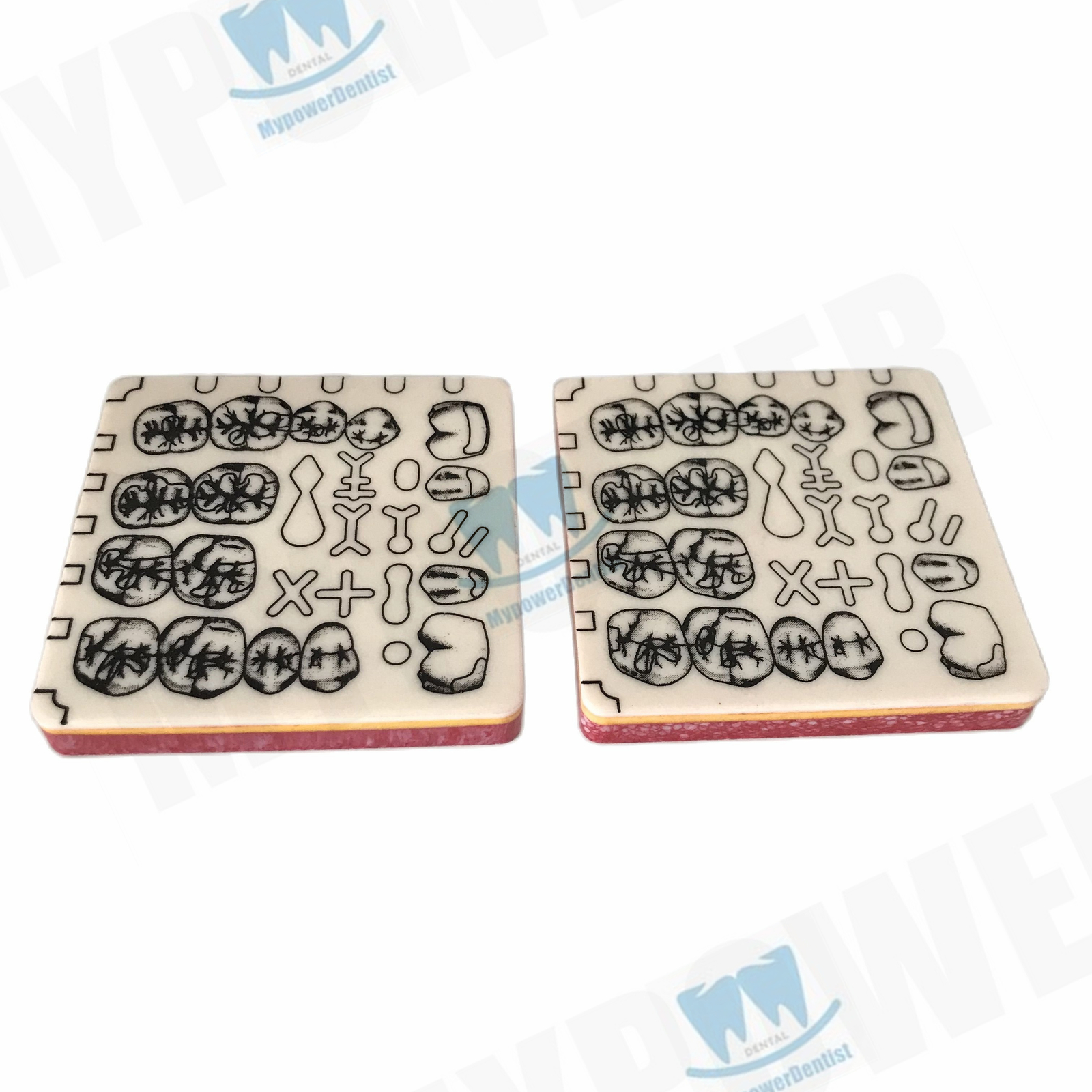 Dental Cavity Preparation/Vitro Decay Caries Model/Composite Resin Filling Model