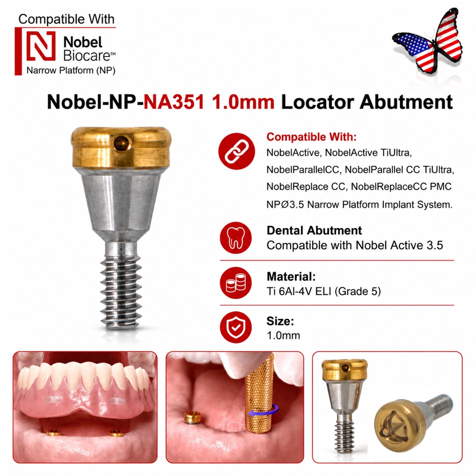 US Nobel Active Locator Abutment & Caps Inserts Kit NP/RP 1-5mm PEEK Retention