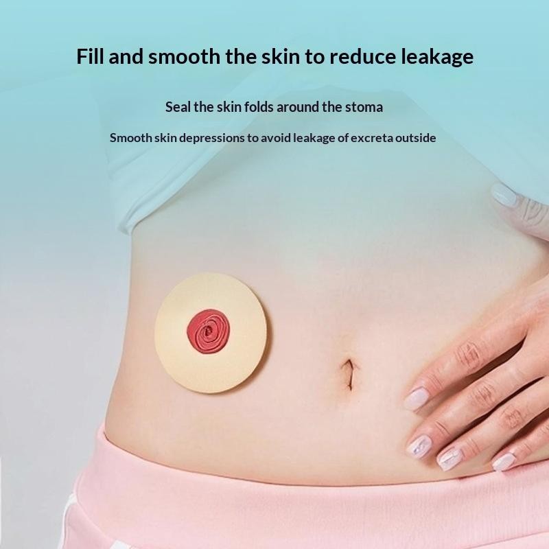 10Pcs Ostomy Paste Ring Baseplates Stoma Care Leak-Proof Ring For Ostomy