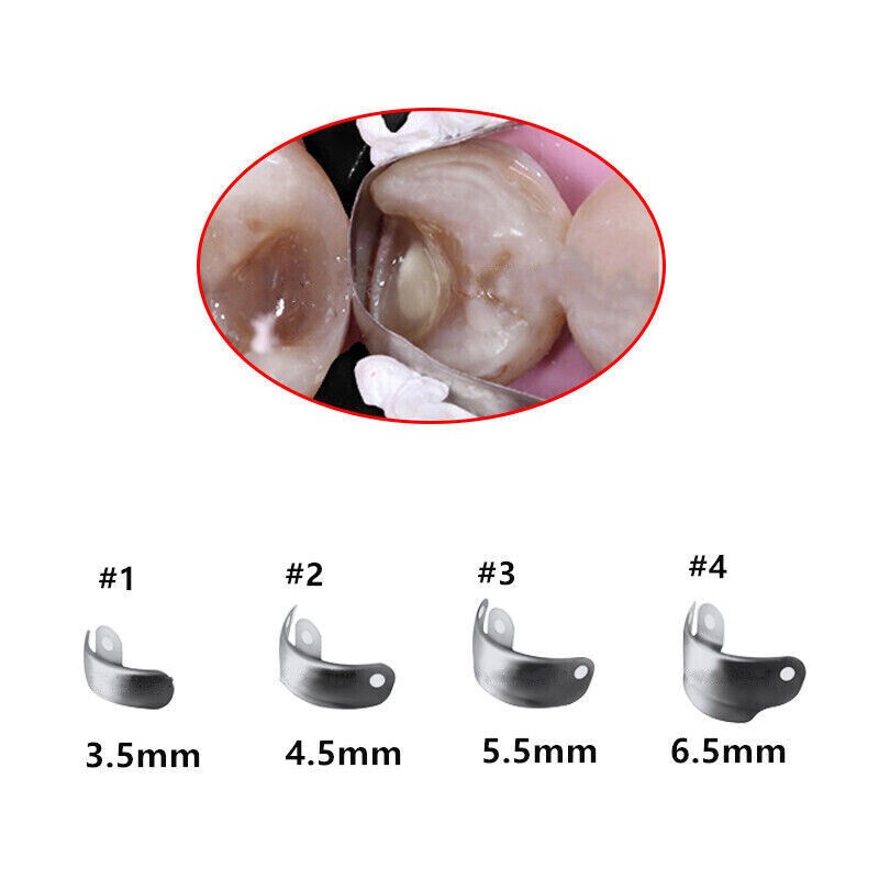 Dental Matrices Bands Sectional Contoured Matrix Refills 3.5/4.5/5.5/6.5 Molar