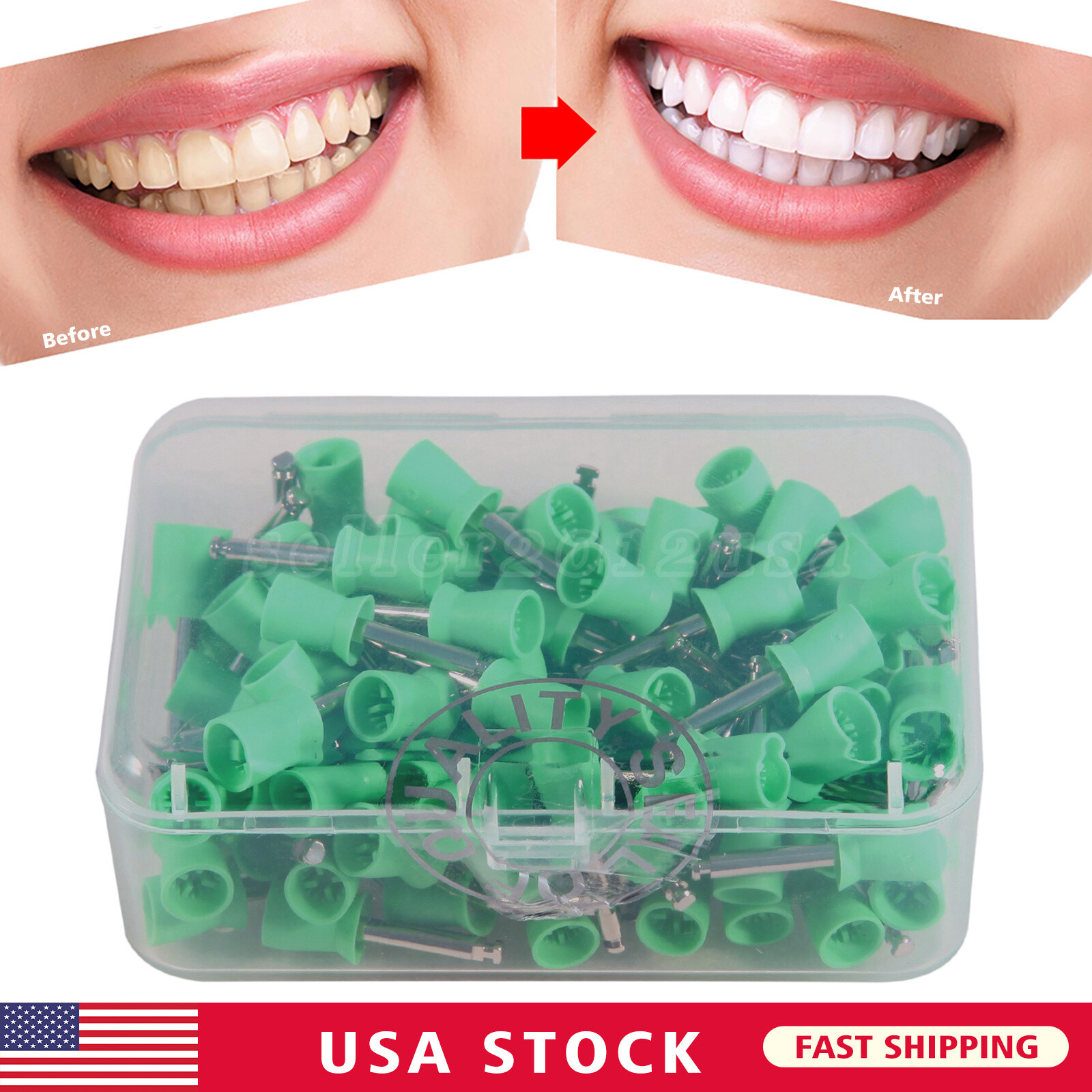 100Pcs/Box US Stock! Dental Teeth Prophy Tooth Polish Polishing Cups green $7.59