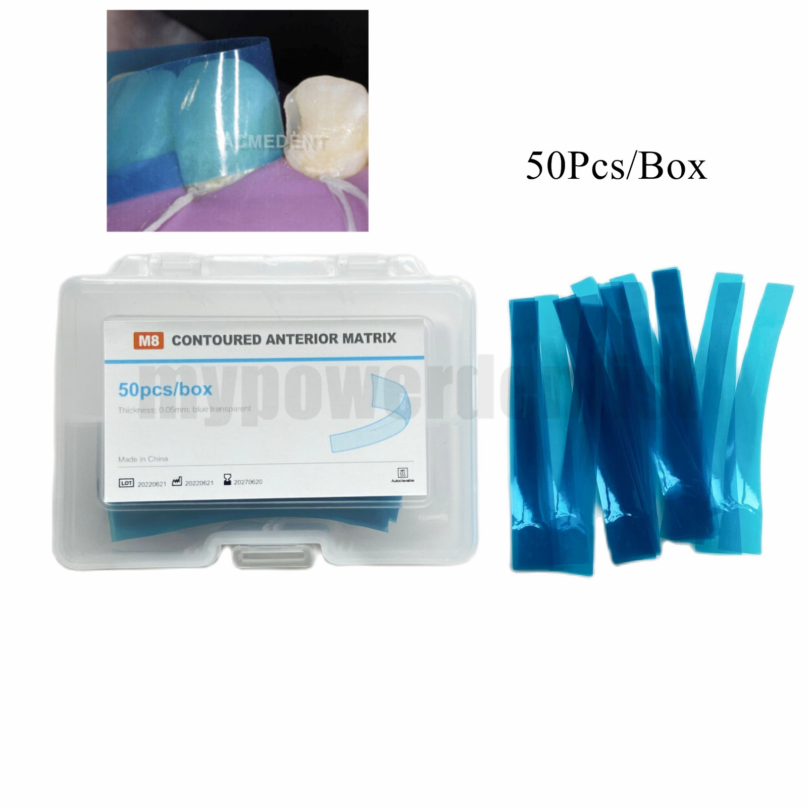 1Box Dental Anterior Restoration Matrix Composite Resin Matrices Blue Strip