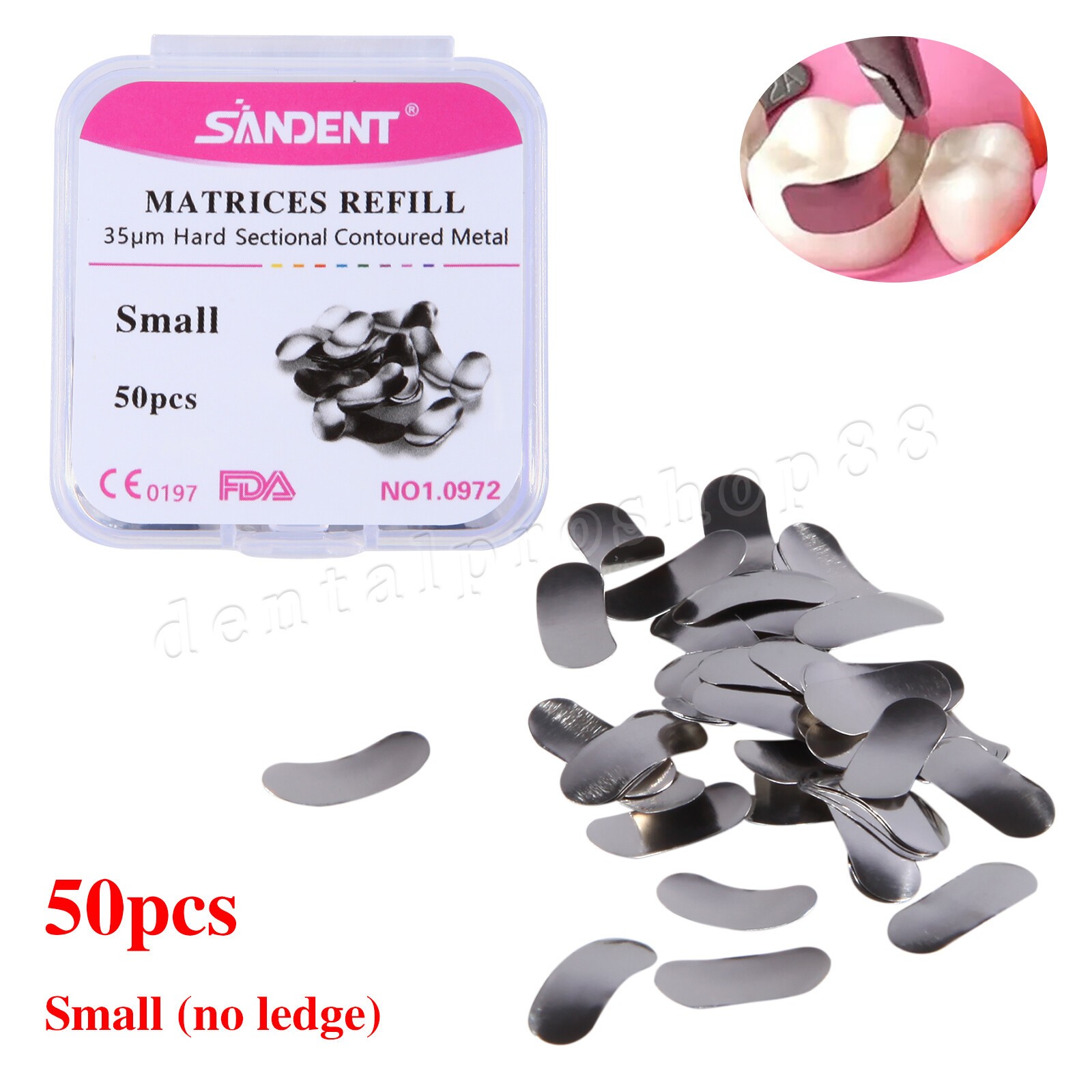 S/M/L 35μm Dental Sectional Contoured Metal Matrices Matrix Refill