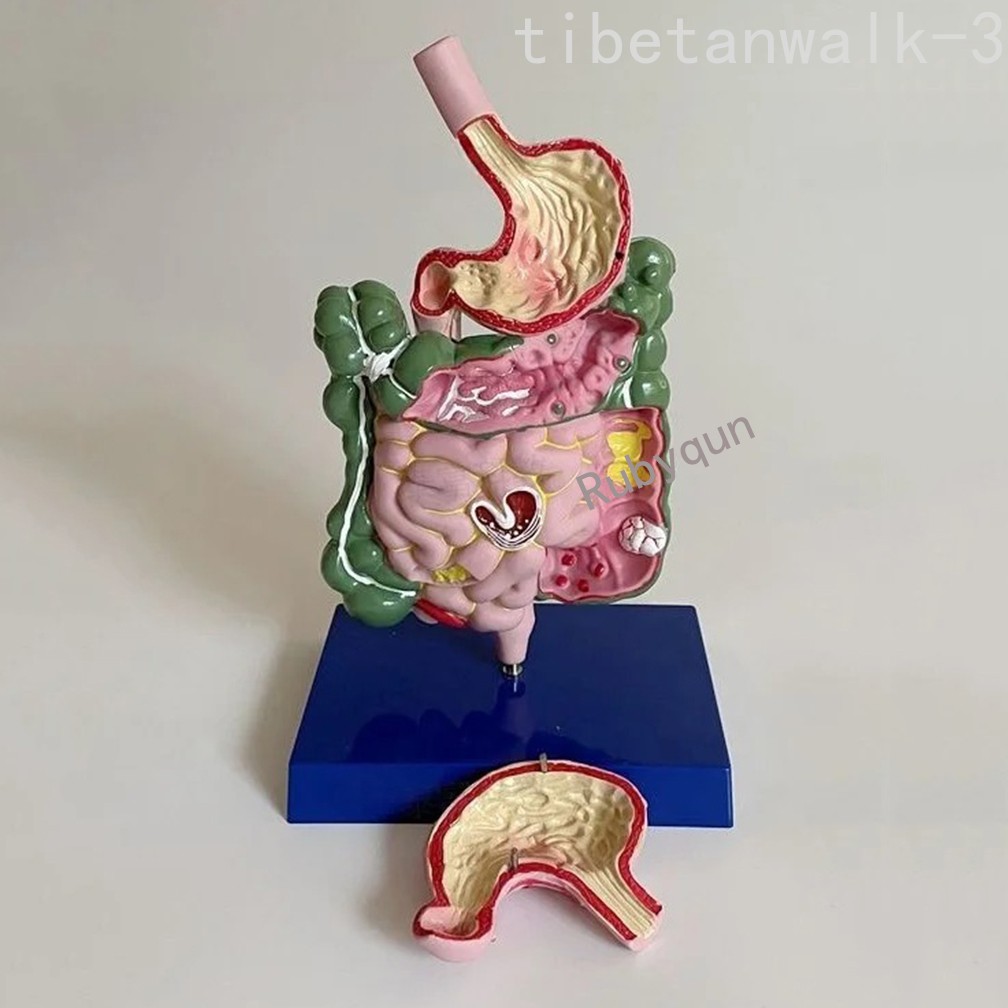 Human Digestive System Model Stomach Esophagus Stoh Large Small Intestine Ileum