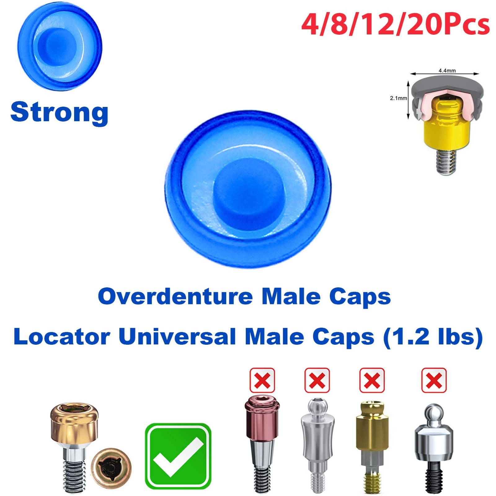 US Dental Overdenture Locator Universal Implant Retention Caps 1.2lbs Blue