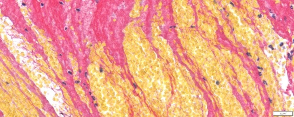VitroView™ Martius Scarlet Blue (MSB) Stain Kit (Cat# VB-3036)