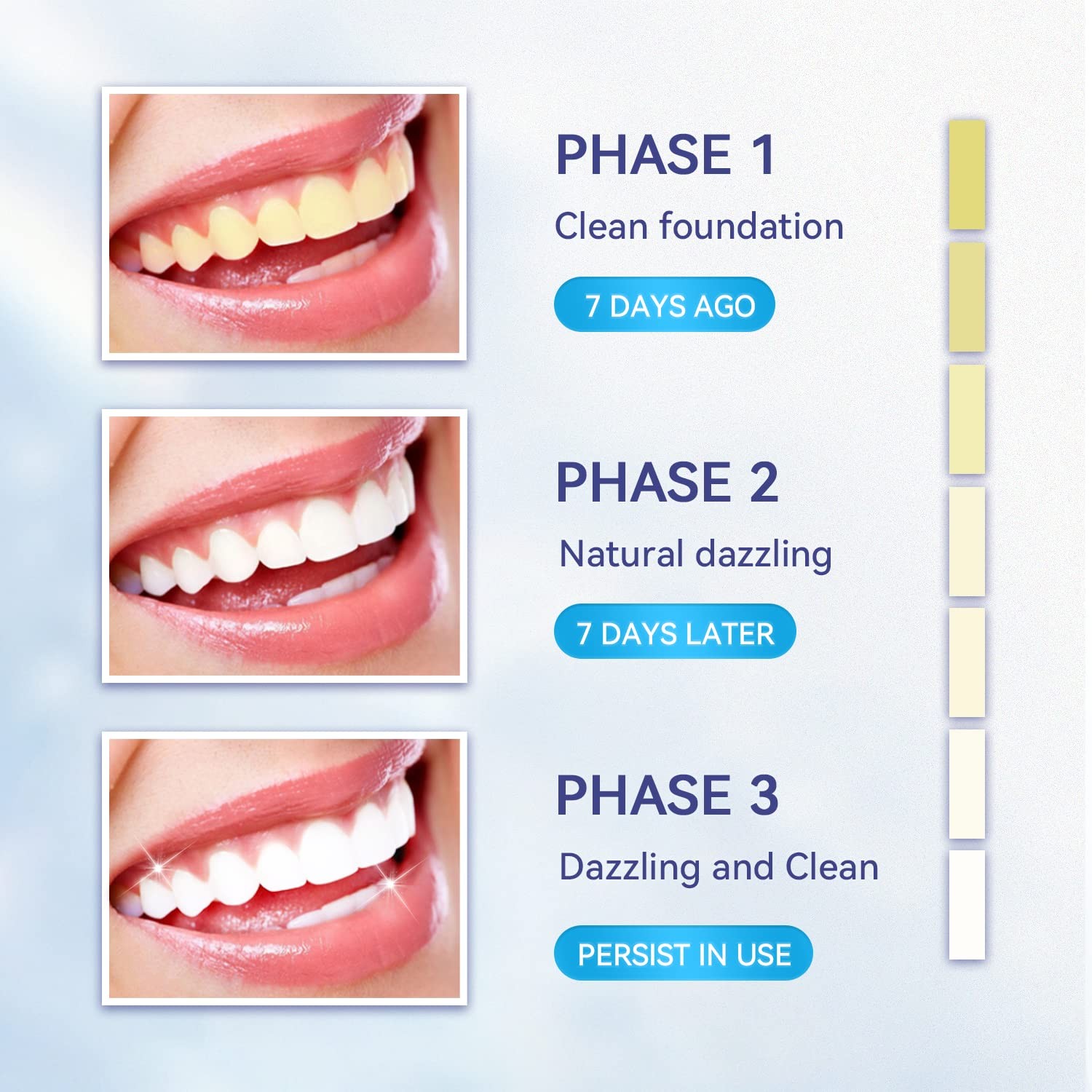 Somall Teeth Whitening Kit – Professional 1 Fl Oz (Pack of 6), Frosted White