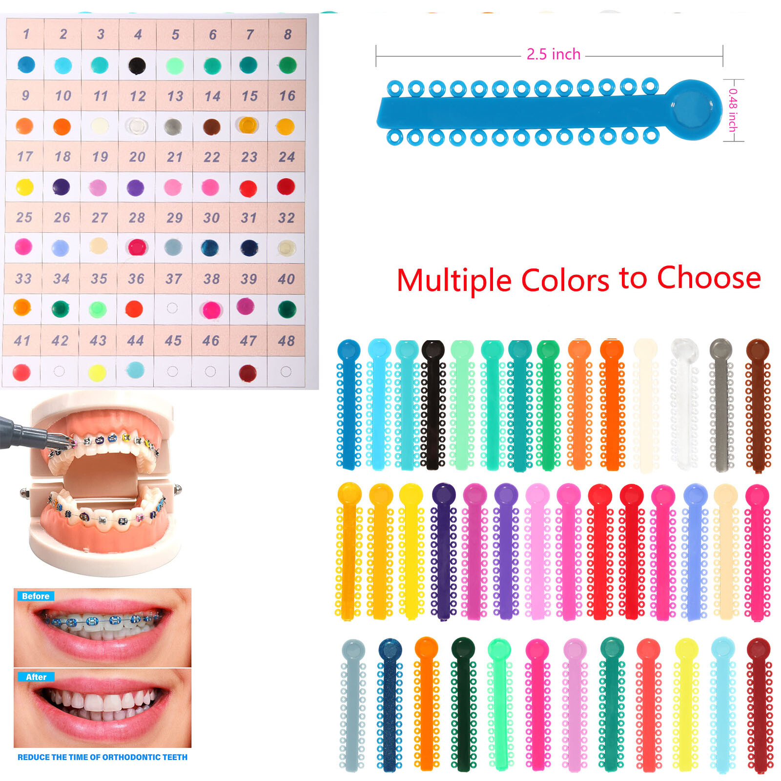 Ligature Gun / 1040 ties Rubber Bands for Orthodontic Dental Braces Brackets