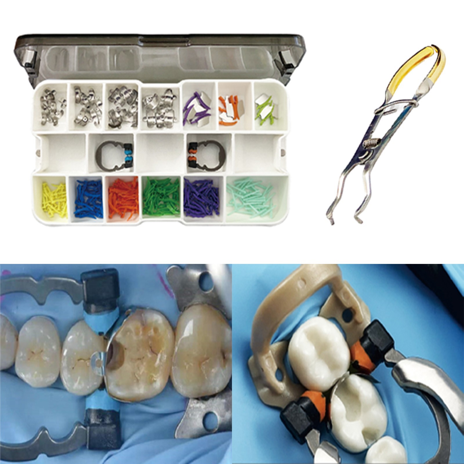 Dental Matrix Bands Ring Kit Sectional Matrice Clamp Garrison Palodent V3 System