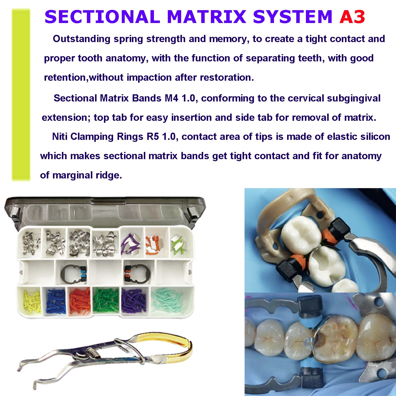 Sectional Matrix System Bands 3D Fusion Professional Kits Garrison Palodent V3