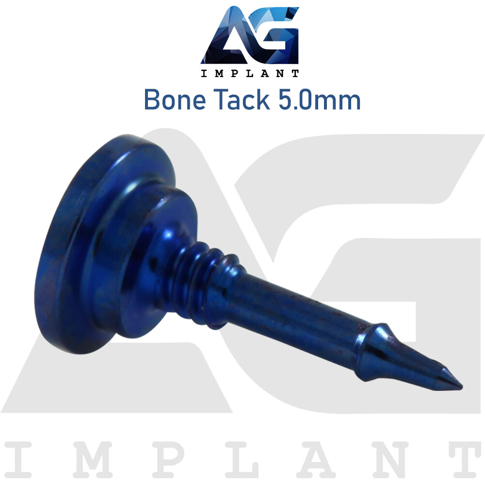 10 Titanium Tack Screw Guided Regeneration GBR Dental Membrane Fix System