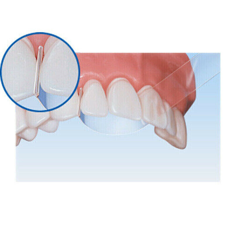 1 Box 100Pcs Dental Transparent Crown Form TOP BM 1.041 Clear Plastic Strips