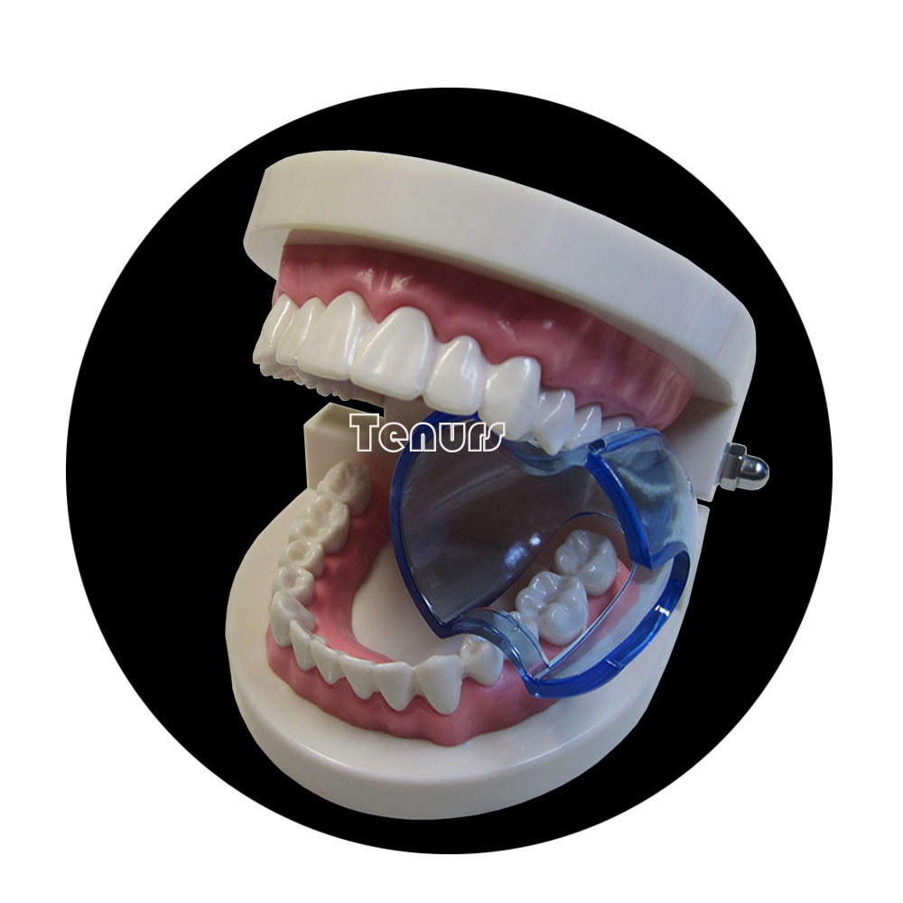 100pcs Denta Autoclavable Lip Retractor Cheek Expander Mouth Opener clear/blue