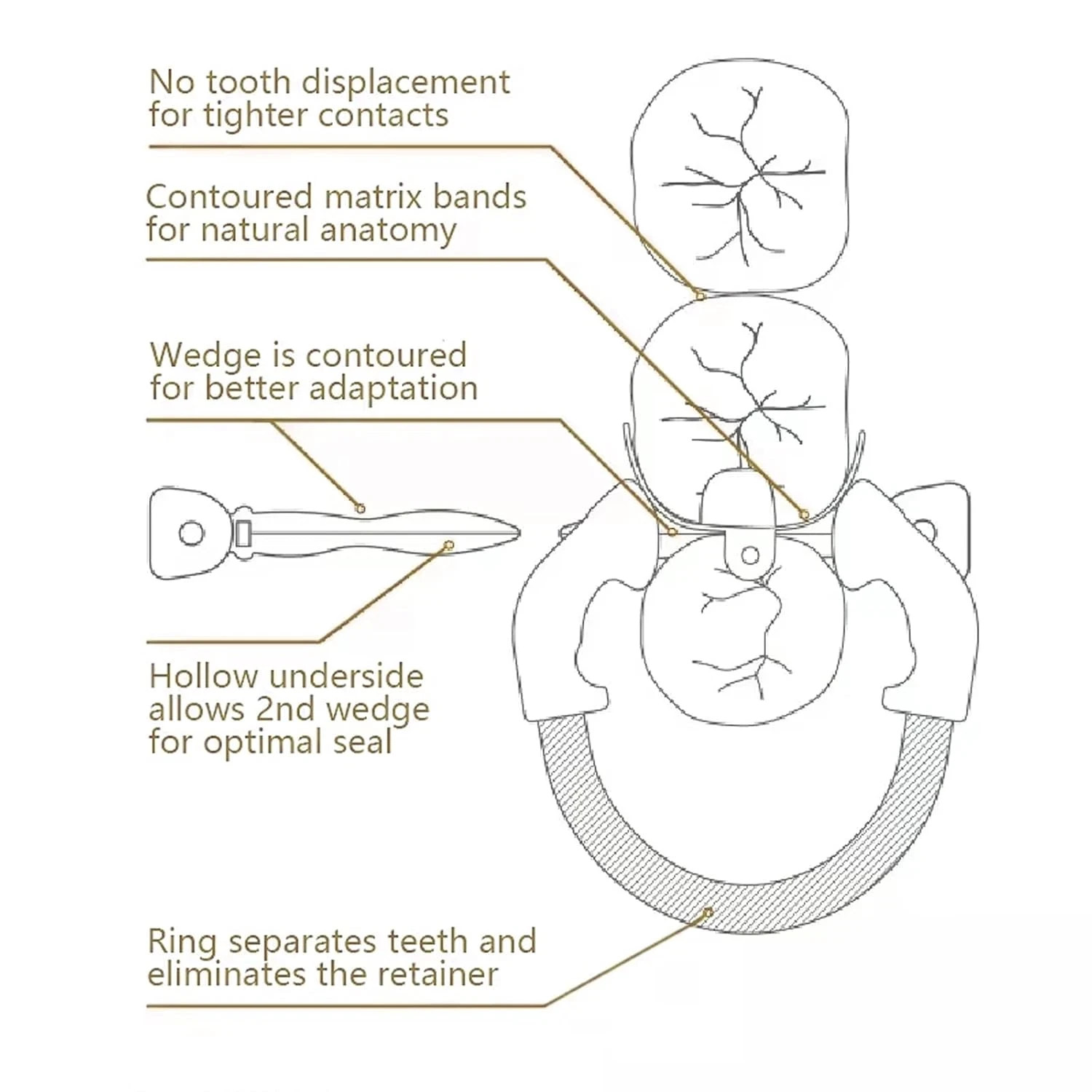 Dental Matrix Bands Sectional Ring Clamp Garrison Palodent V3 System Restoration