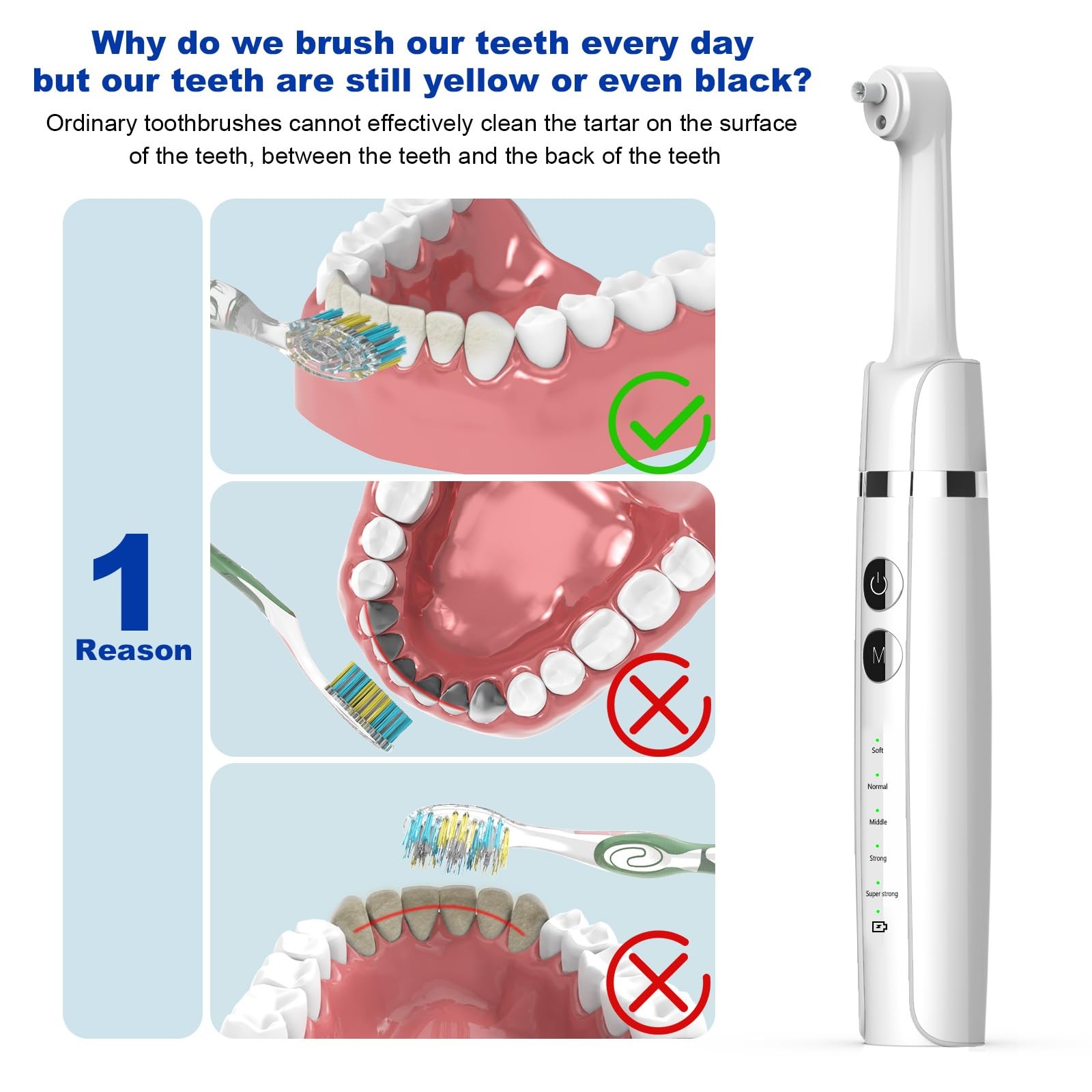 Tooth Polisher,Teeth Polishing Kit for Daily Cleaning,Polishing Then Whitenin…