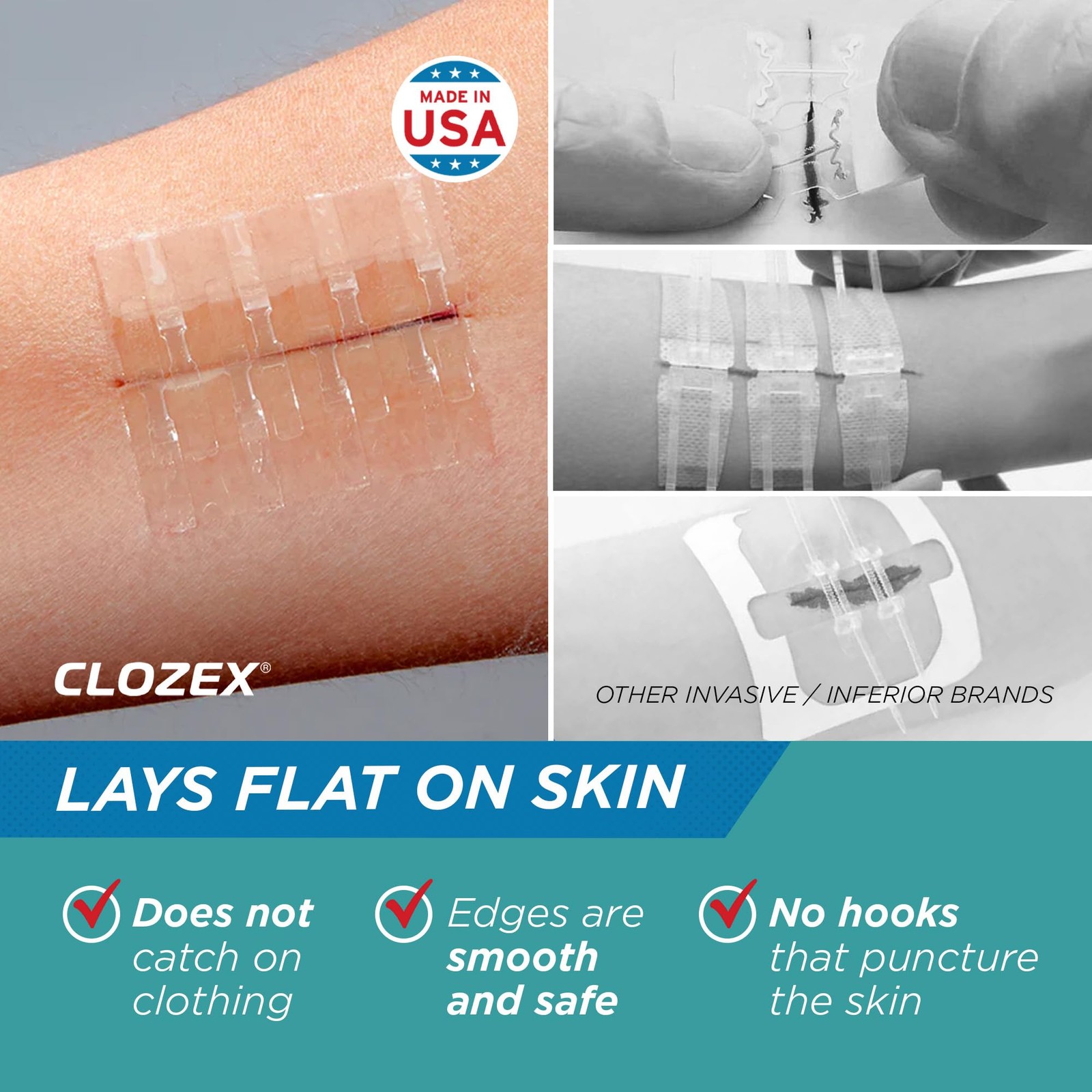 Clozex Pediatric – Without Stitches Fsa Hsa Eligible Skin