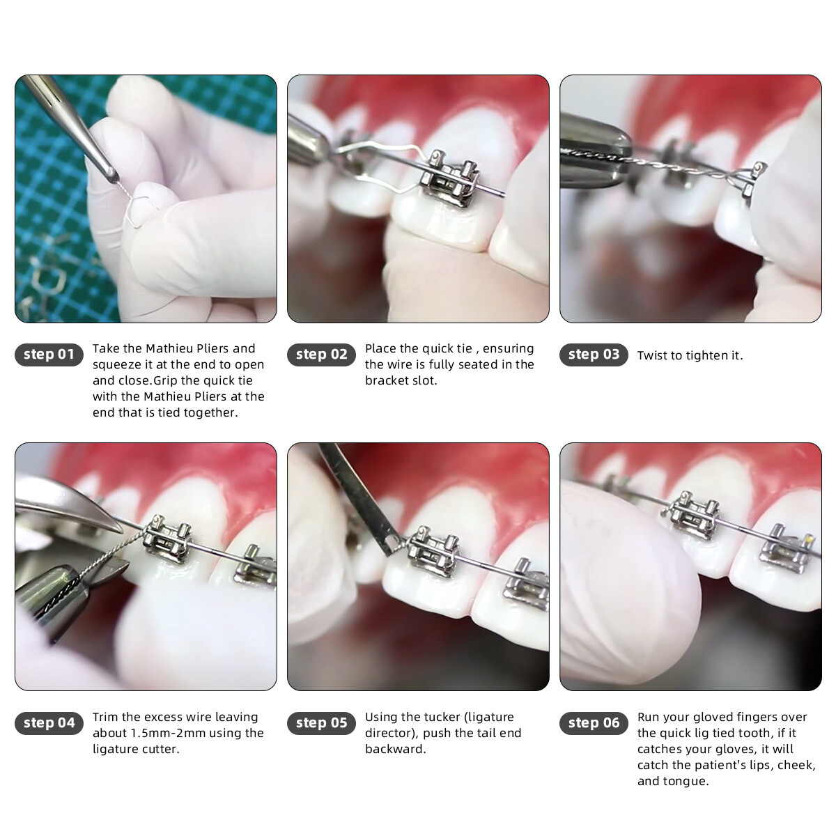 Dental Orthodontic Stainless Steel Wire Preformed Ligature Ties Long/Short/Twist