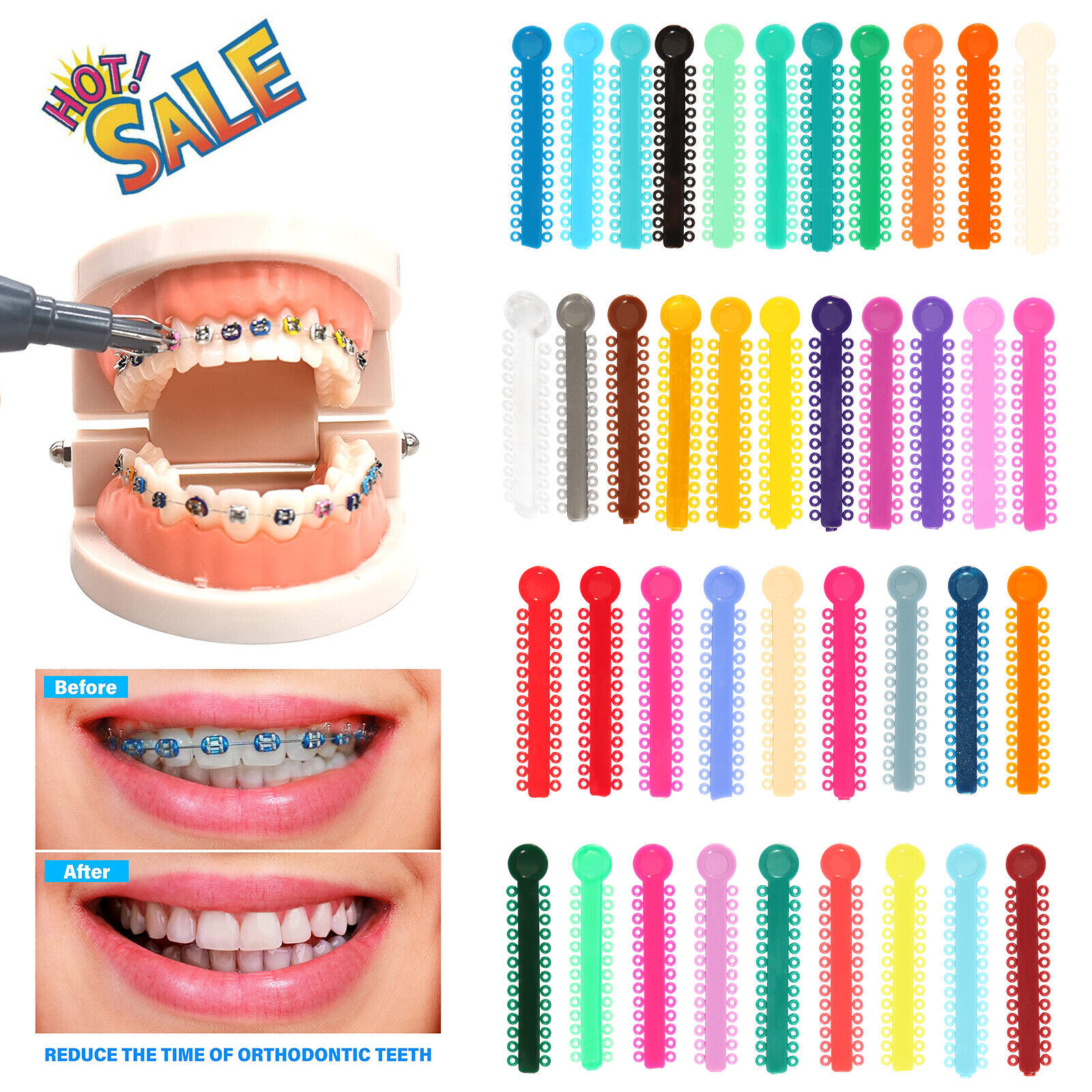 Ligature Gun / 1040 ties Rubber Bands for Orthodontic Dental Braces Brackets