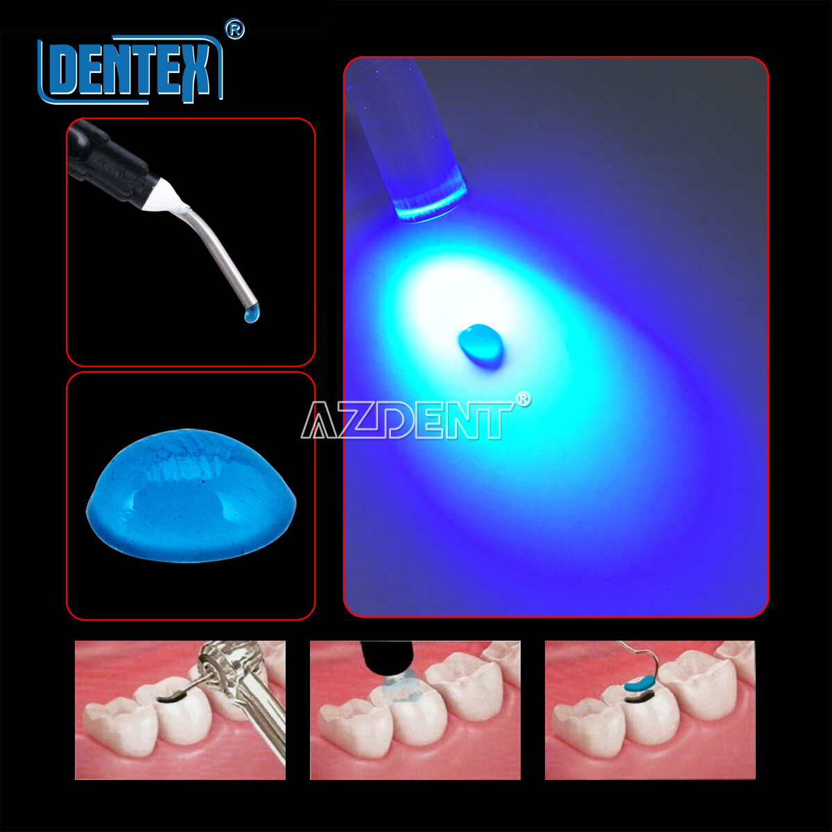 Dental Temporary Flow Light Cure Filling Composite Material Resin Blue Dentex US