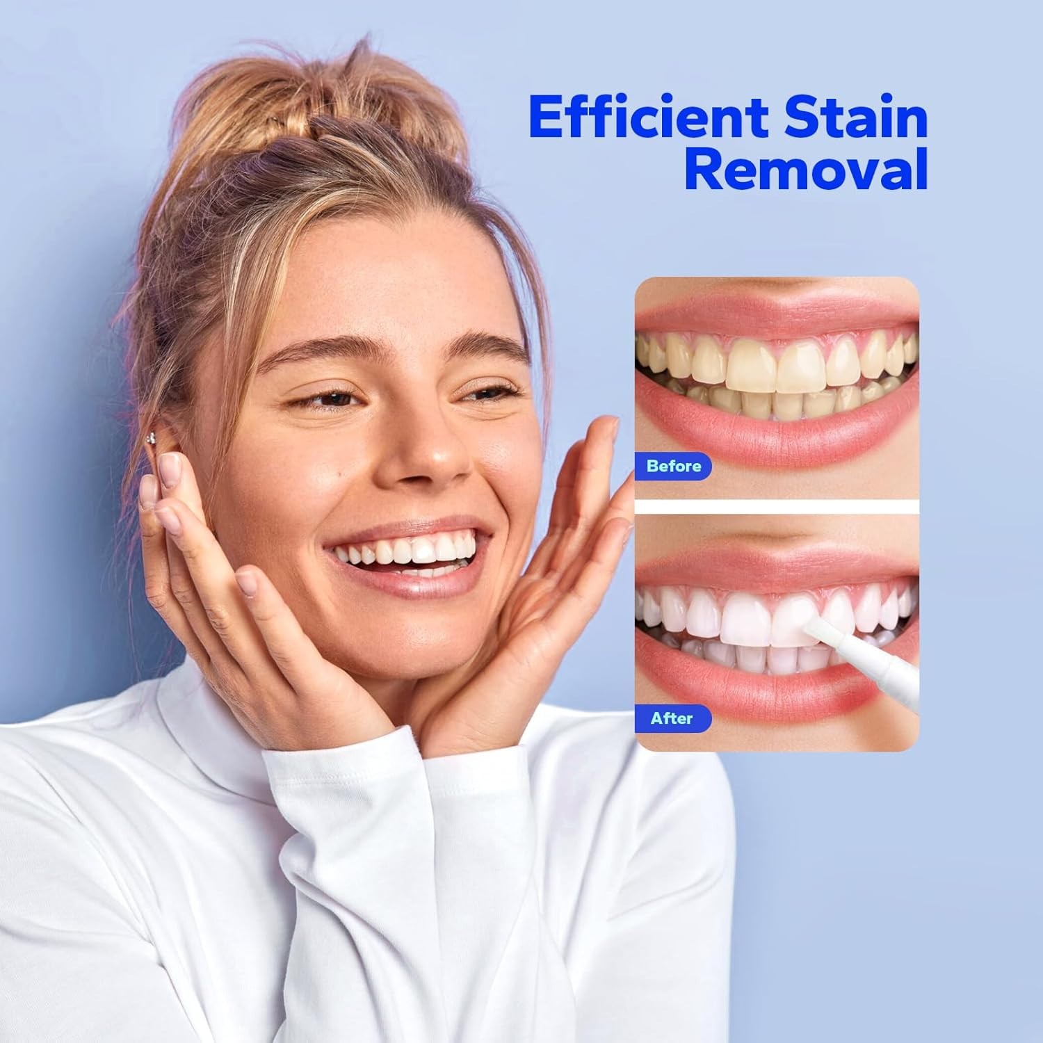Premium Teeth Whitening Pens (4 Count), Sensitive-Free Whitening Gel