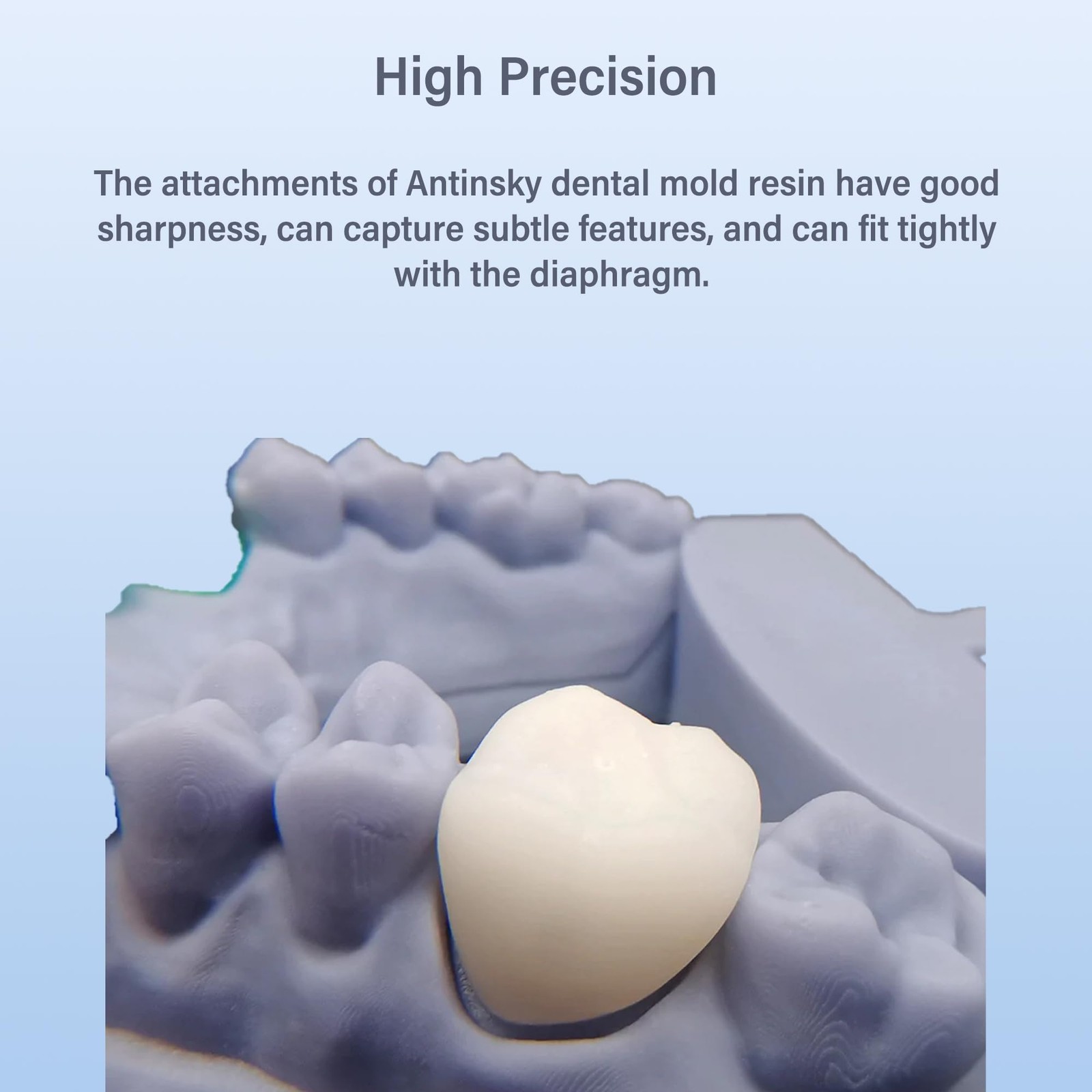 Antinsky Temporary Dental Model Resin for DLP LCD 3D Printer 405nm A1