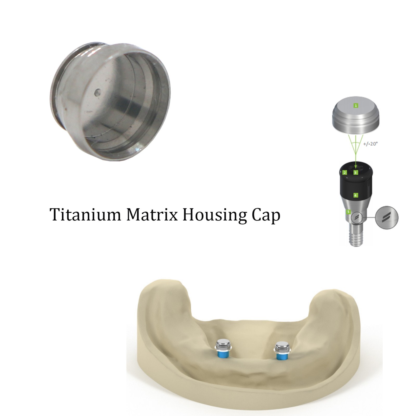 Dental Locator Retention Insert Novaloc Peek Cap Denture Cap Assembly Processing