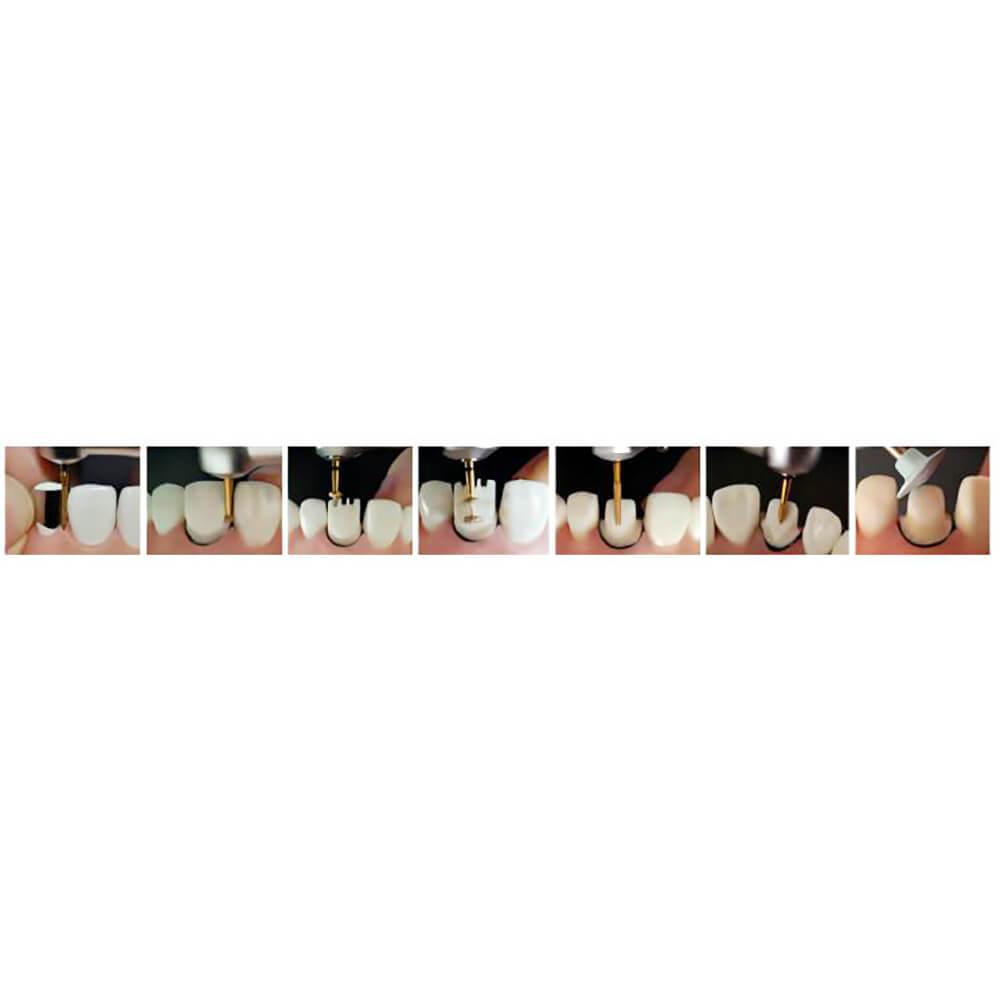 1 Kit Dental kit of Preparation Anterior Teeth FOR CERAMICS/ZIRCONIA CROWN 10pcs
