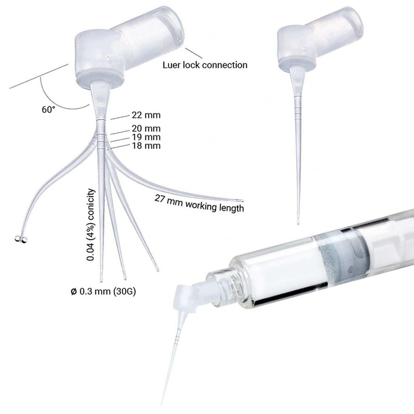 Dental 60° IrriFLEX Root Canal Irrigation 2 holes 30GA Luer Lock SM