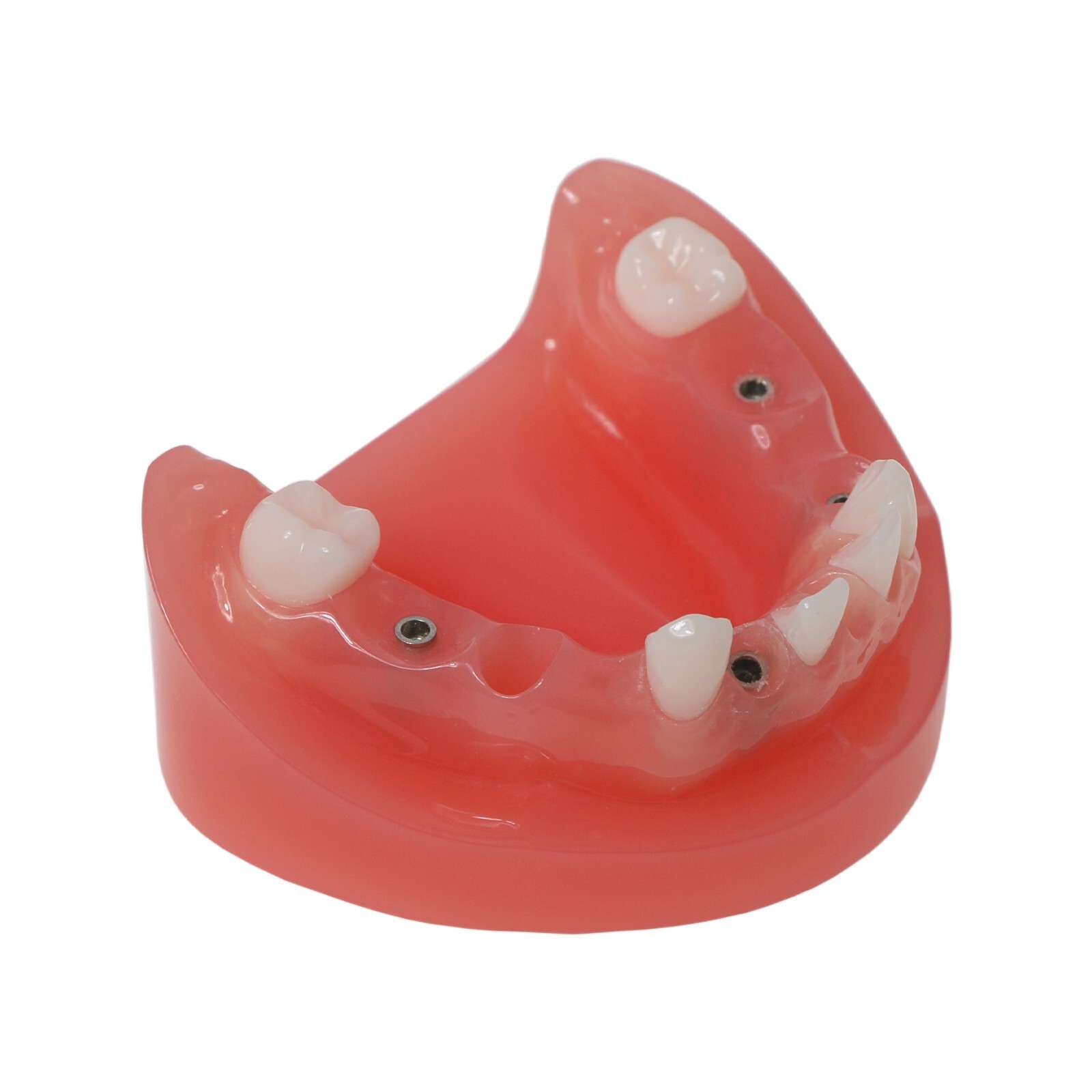 Dental Typodont Teeth Model Implant Pathological Perio Restoration Practice Demo