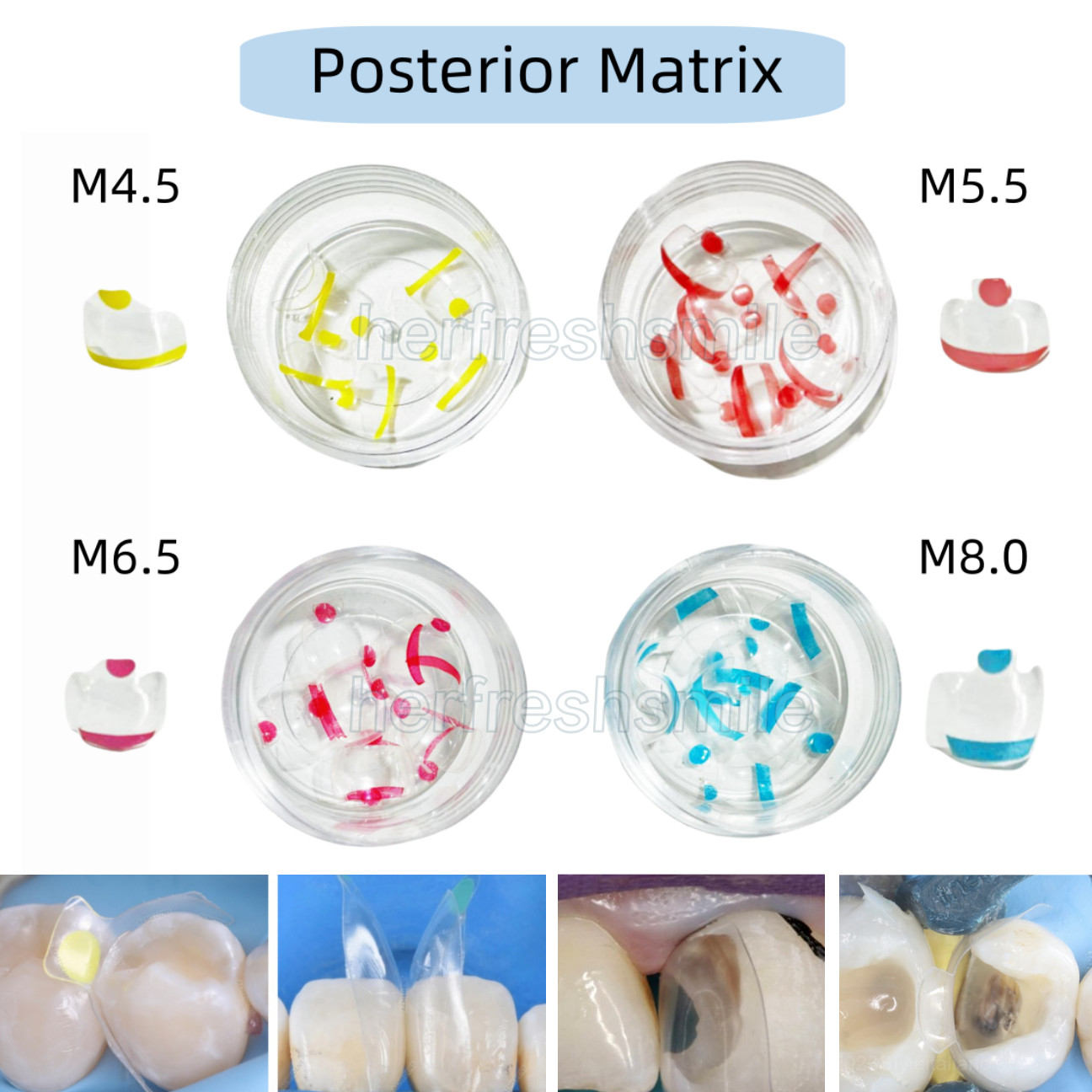 Dental Clear Matrix Transparent Restoration BT Bow Matrices Contoured BioClear