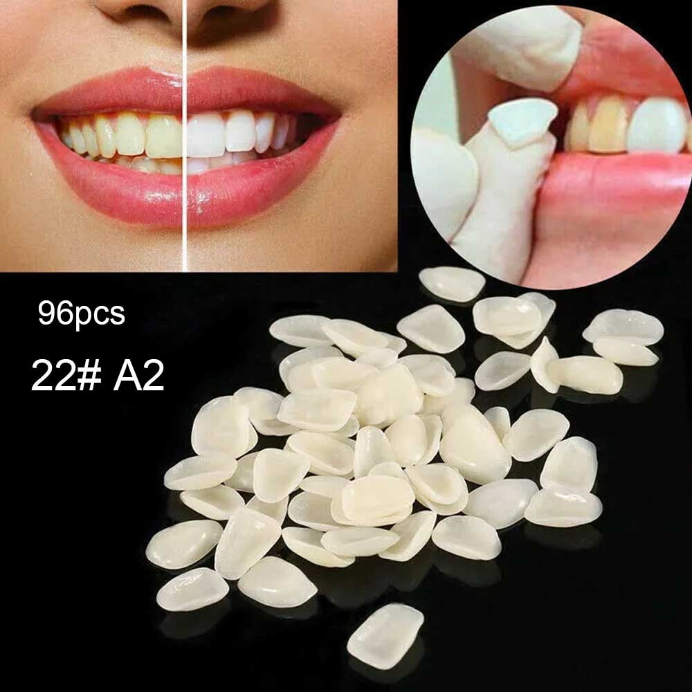 96pcs Dental Tooth Veneer Anterior Resin Thin Teeth Veneers Porcelain 22# A2 US