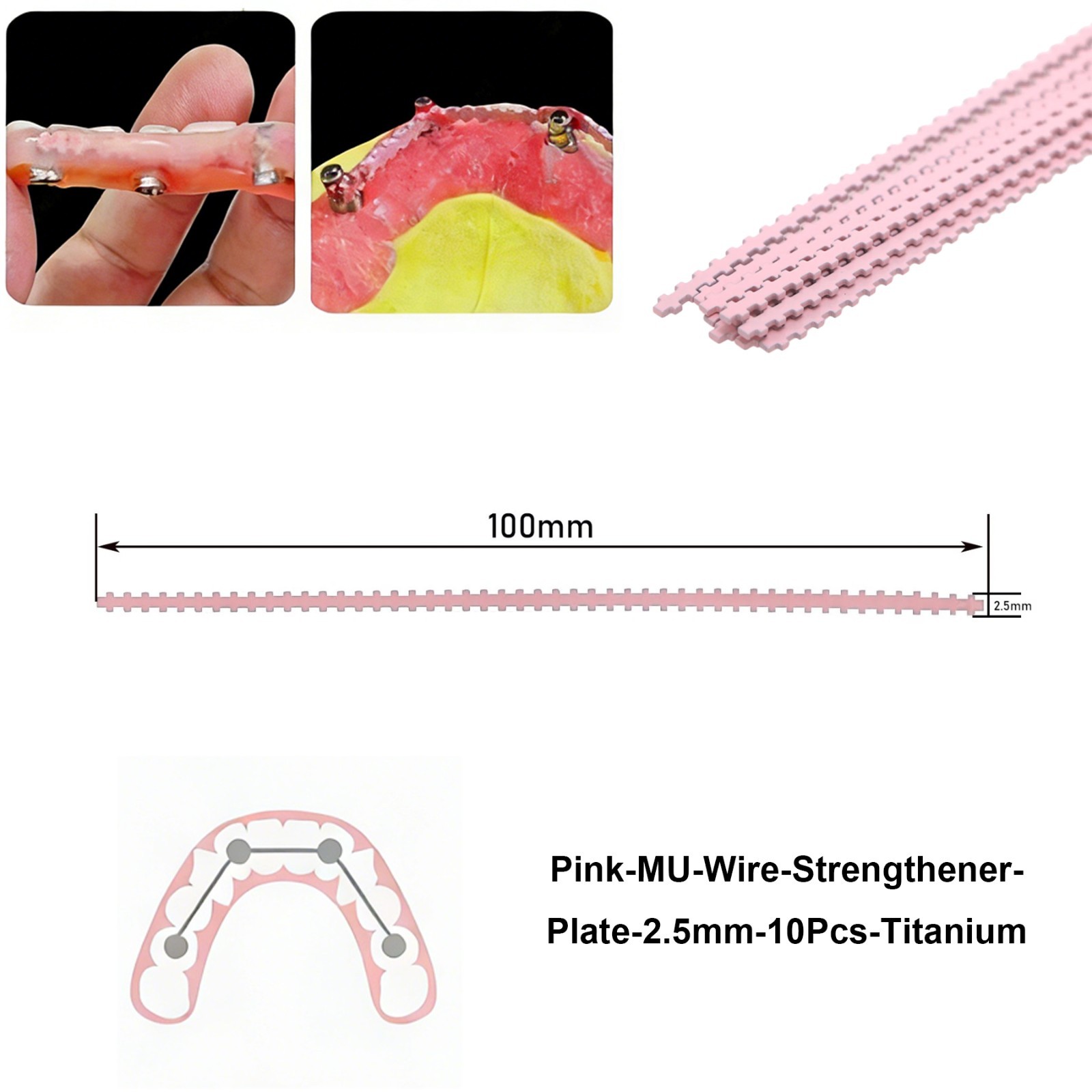 10PCS Implant Connector Titanium MU Wires Pink Overdenture Strengthener Plate