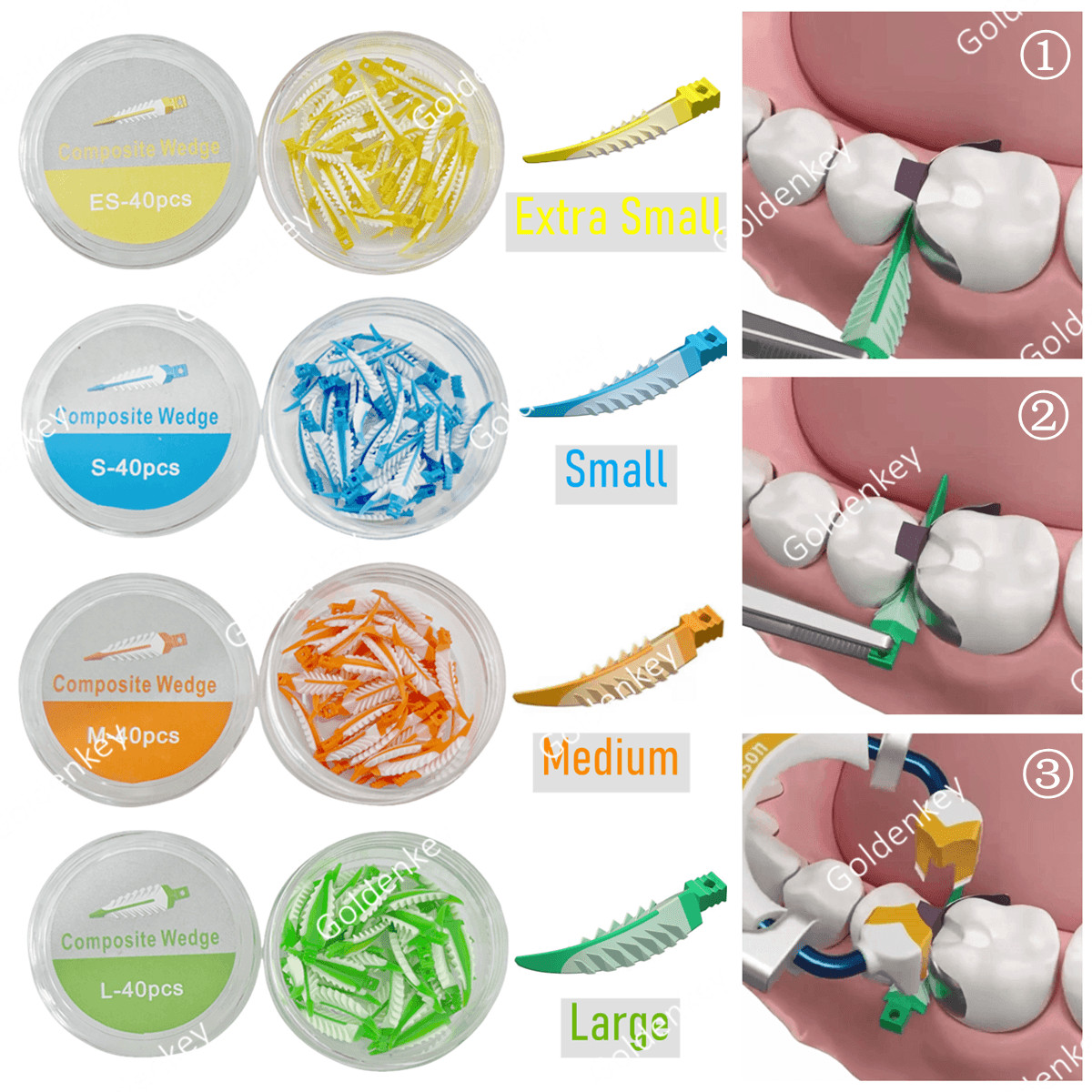 Dental Matrix Ring Clamp Endo Strata Wedges 3D Composite Kits Fits Garrison