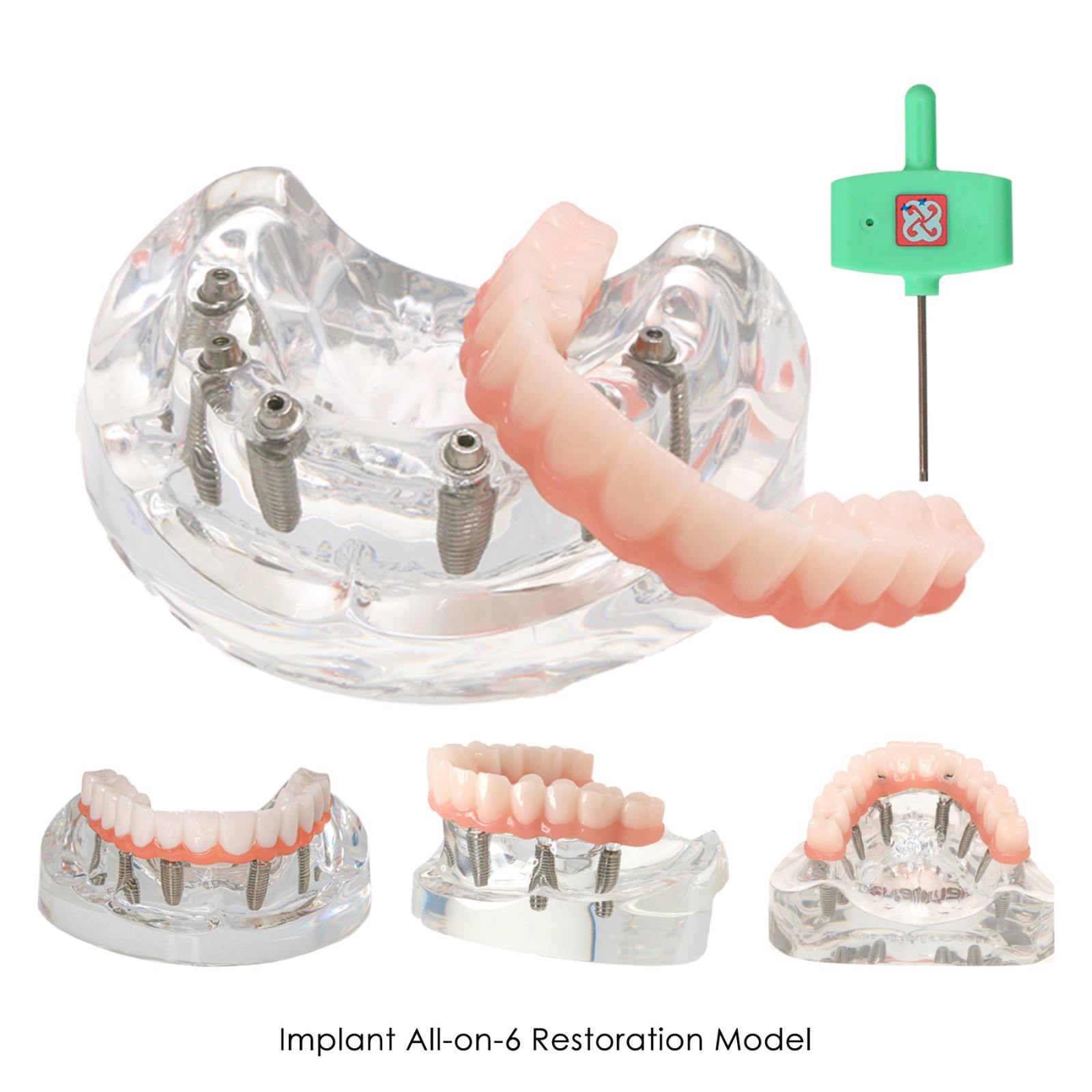 Dental Implant Overdenture Model All-On-6 Treatment Upper jaw 6 Screws, Clear US