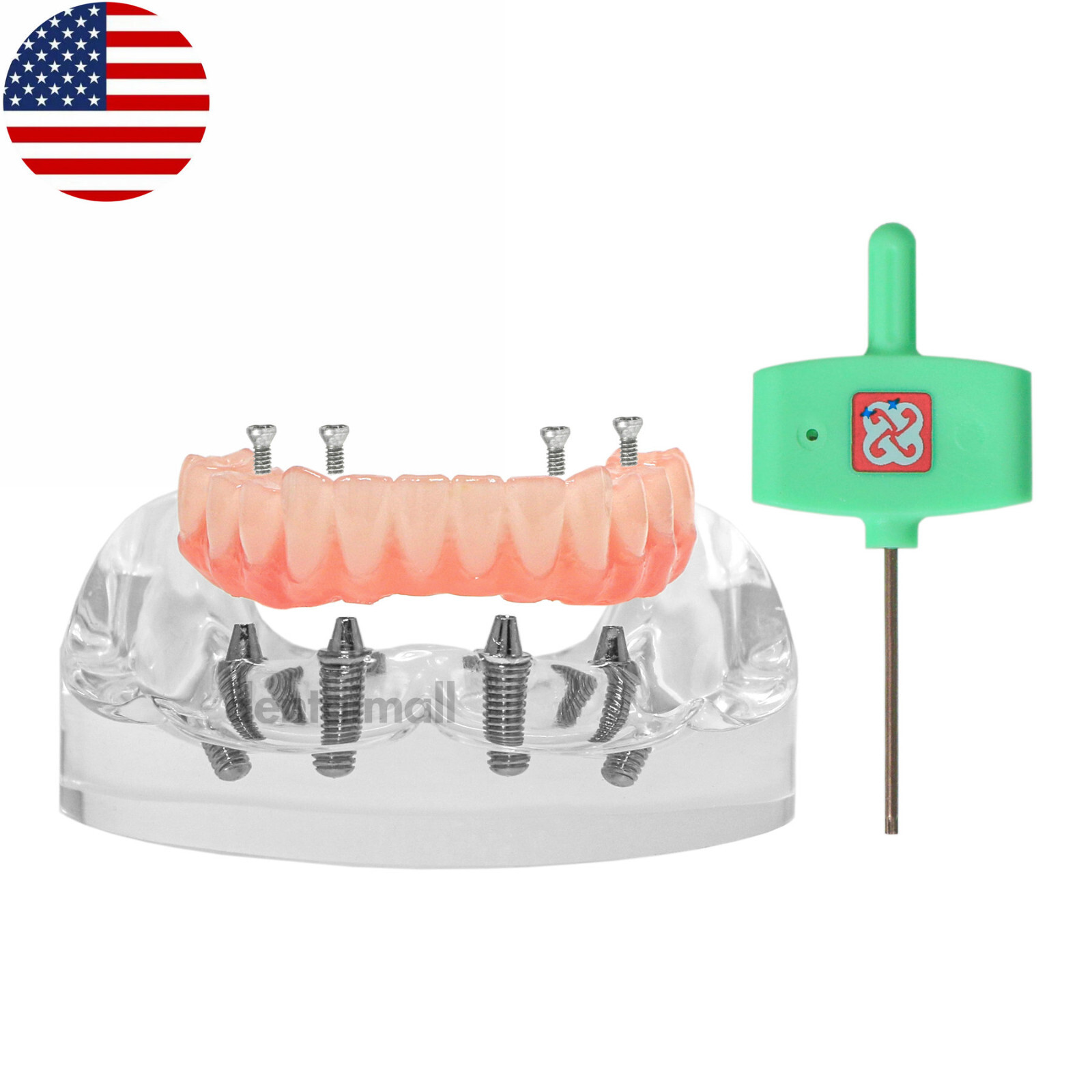 US Dental 4 Screws Overdenture Model All on 4 Restoration Upper/Lower Jaw Type