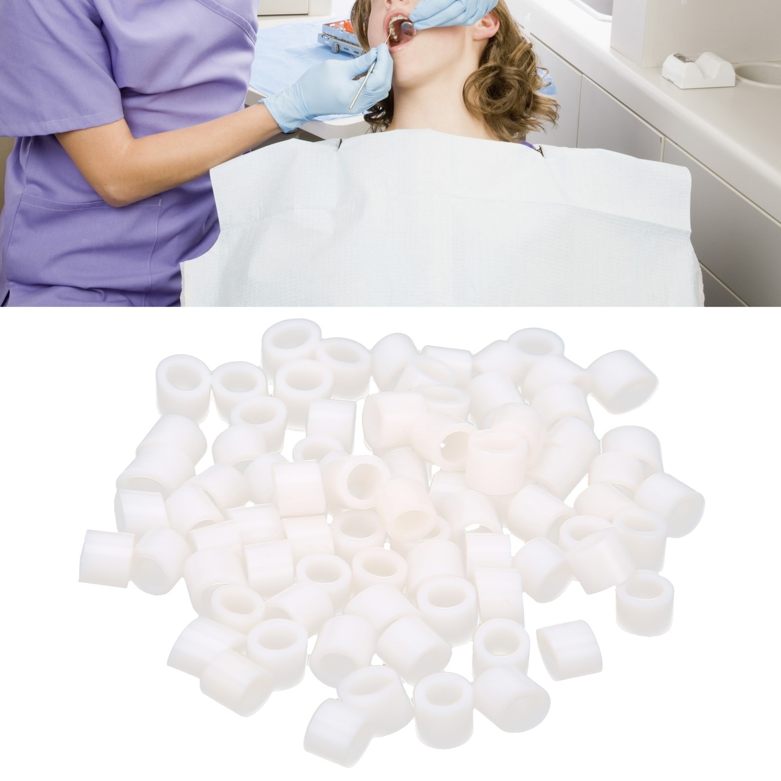 100pcs Dental Code Rings – Practical Silicone Coding Solution Easy To Use