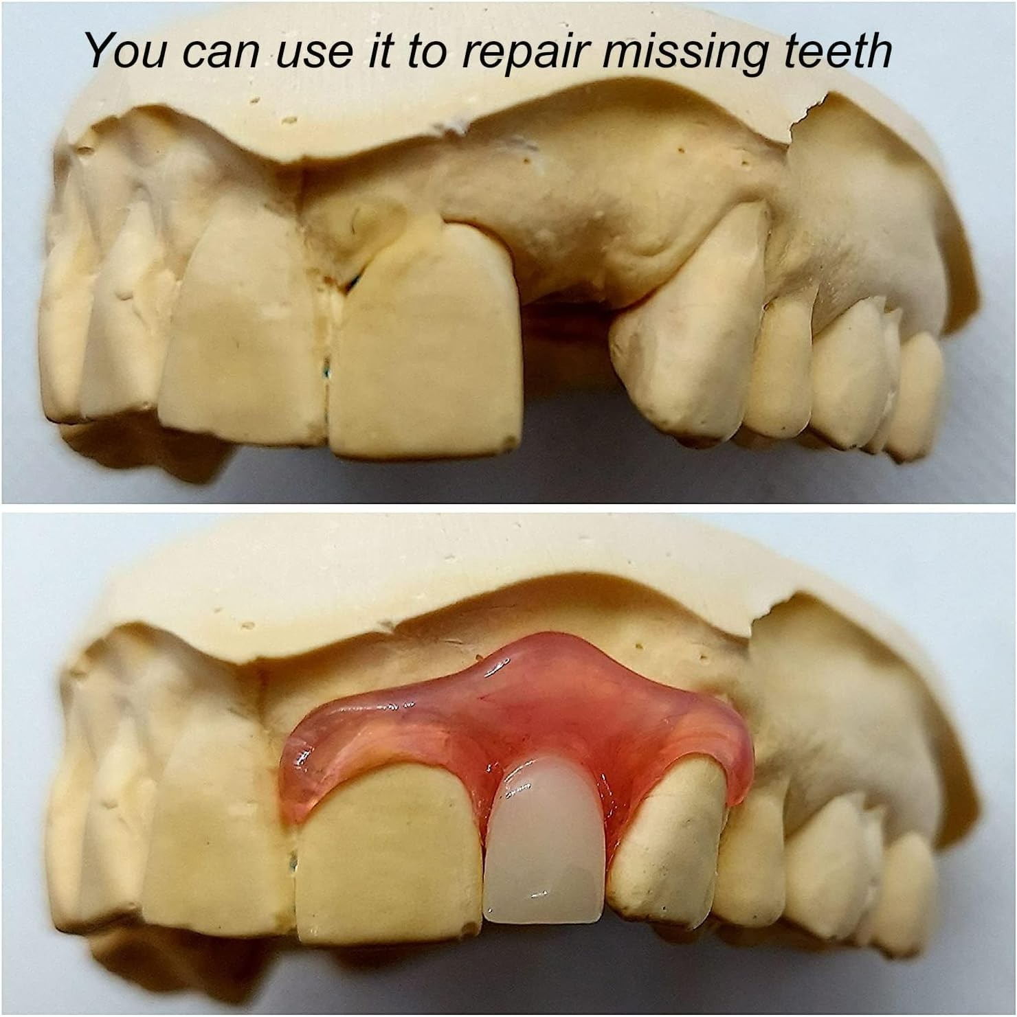Quick Fix Gum Material for Missing Teeth – 22 Strips for Smile Enhancement