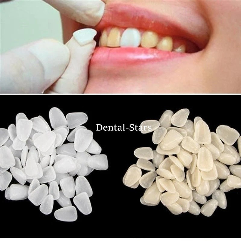 50 Pcs Dental Ultra Thin Whitening Porcelain Teeth Veneers Resin Teeth Anterior