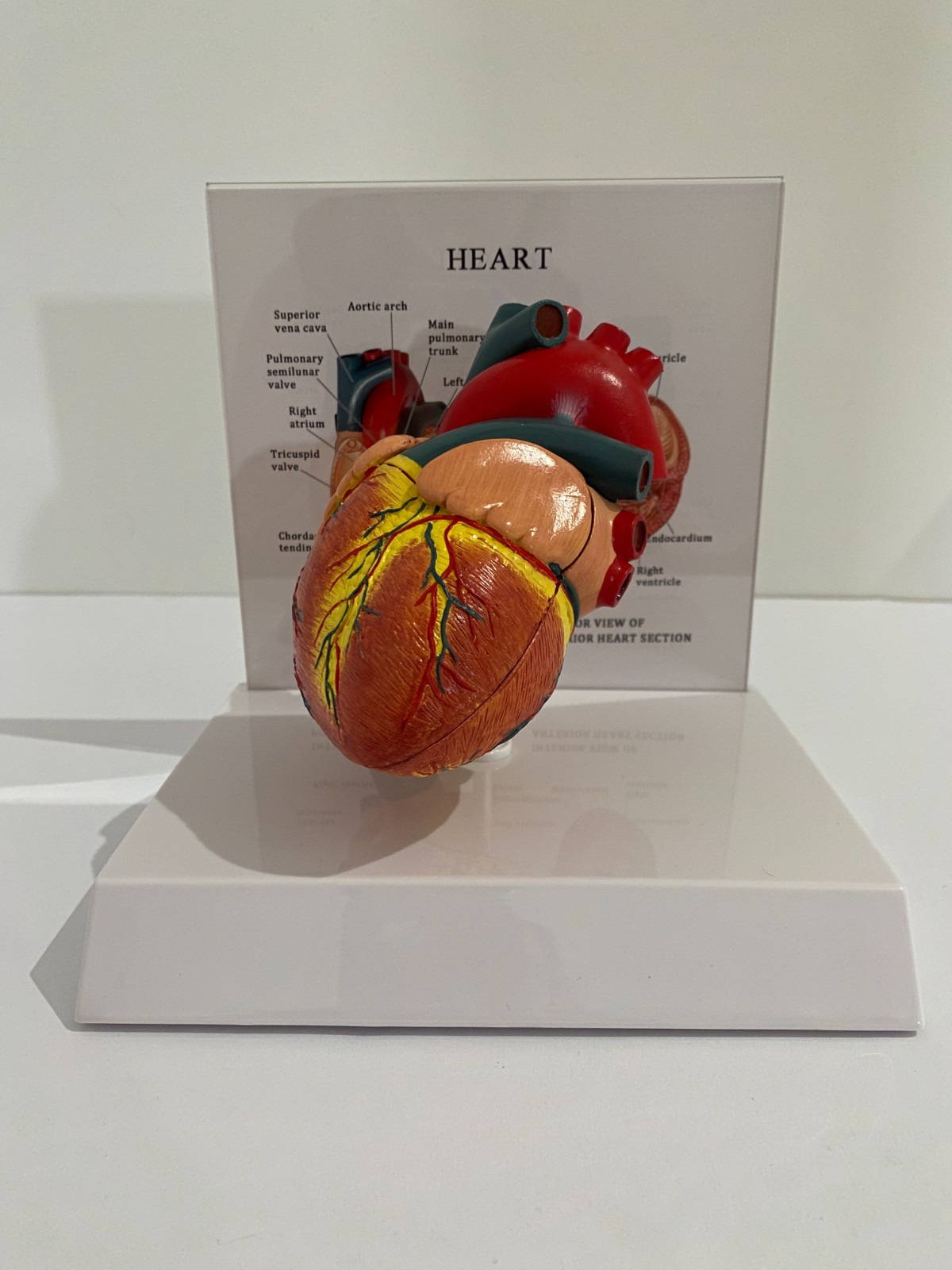 Anatomical Advanced Life Size Heart Model – Medical Cardiovascular Anatomy
